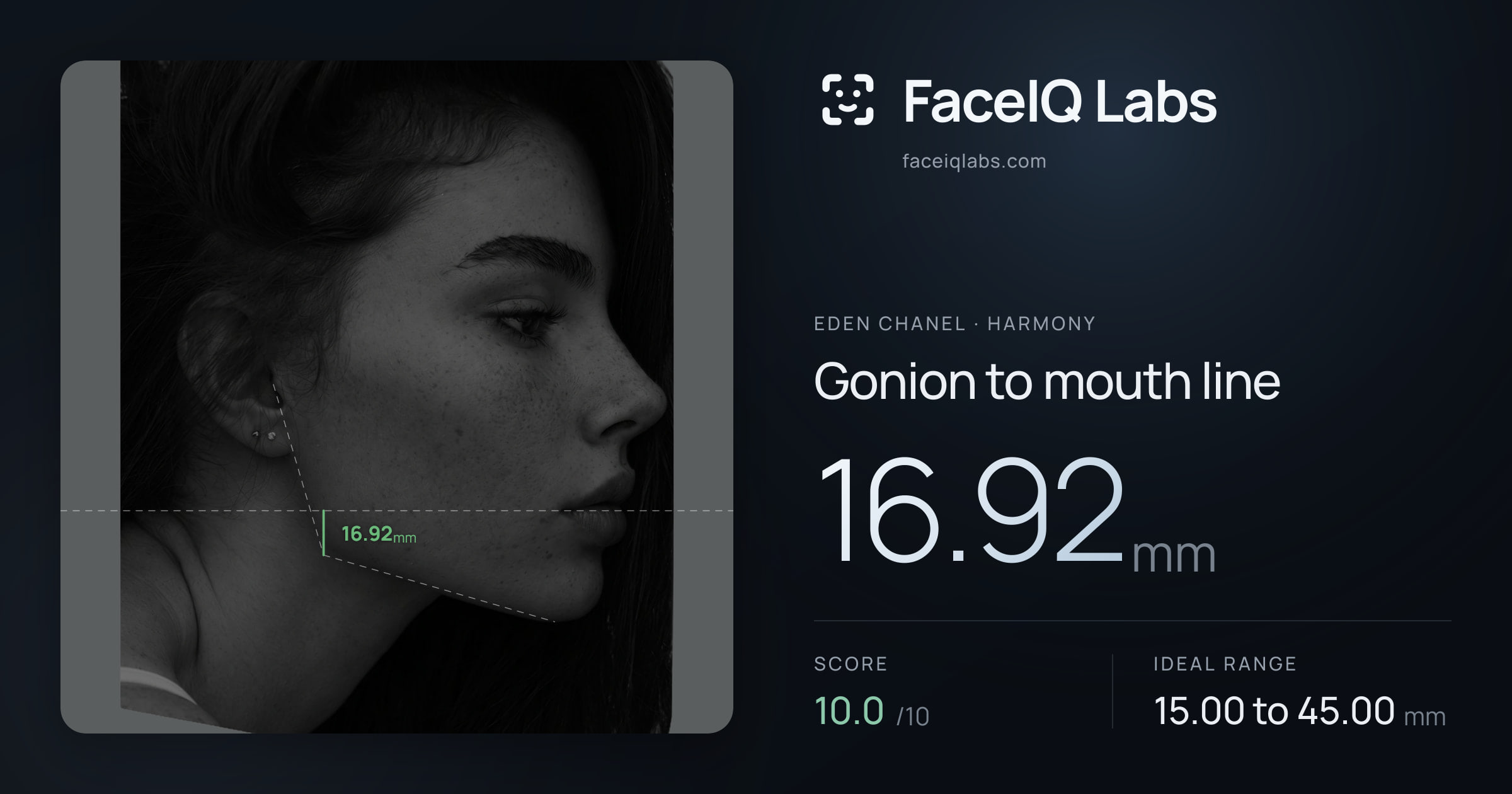 Eden Chanel Gonion to mouth line: 16.92mm, drawn on the photo
