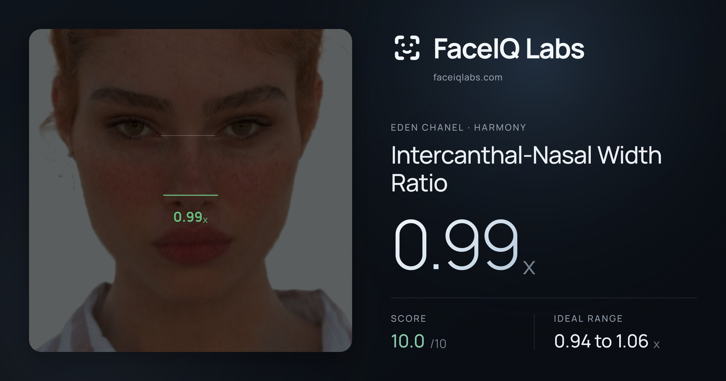 Eden Chanel Intercanthal-Nasal Width Ratio: 0.99x, drawn on the photo