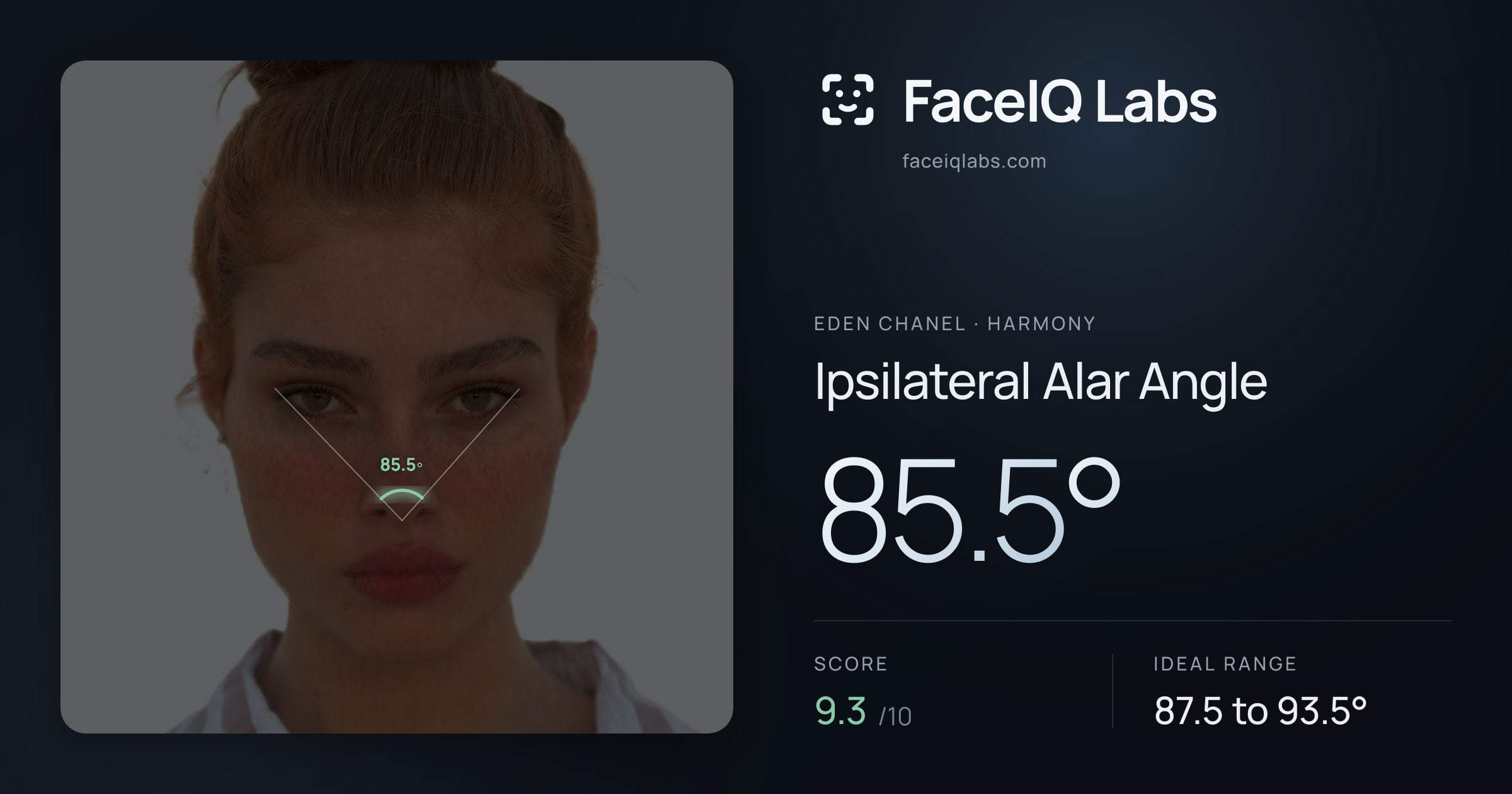 Eden Chanel Ipsilateral Alar Angle: 85.5°, drawn on the photo