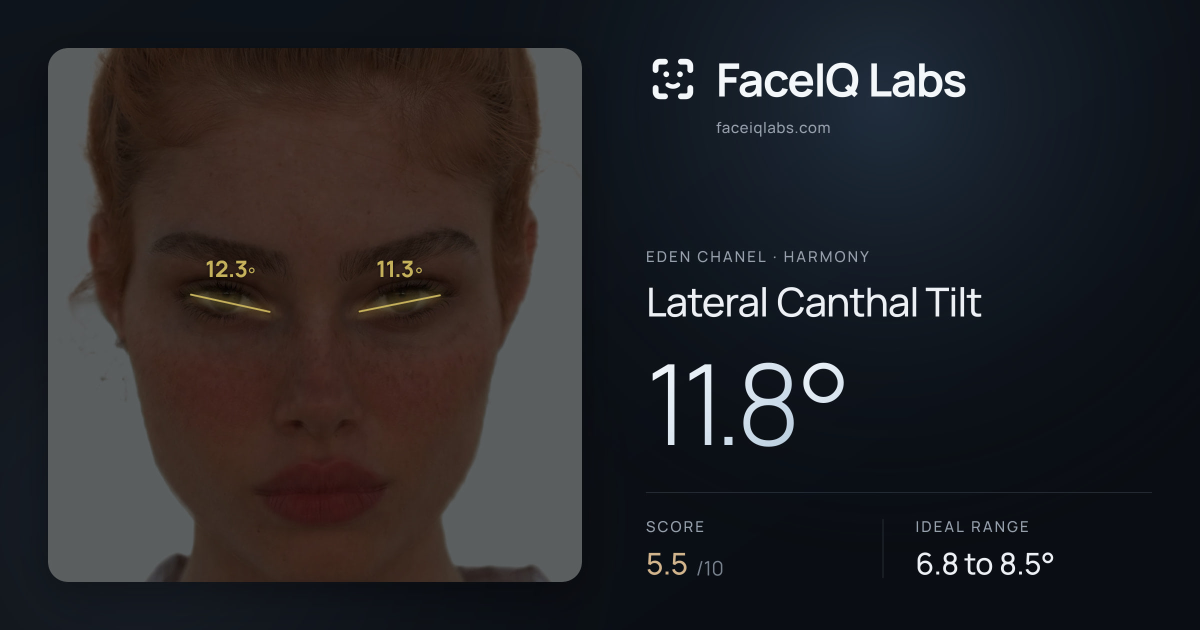 Eden Chanel Lateral Canthal Tilt: 11.8°, drawn on the photo