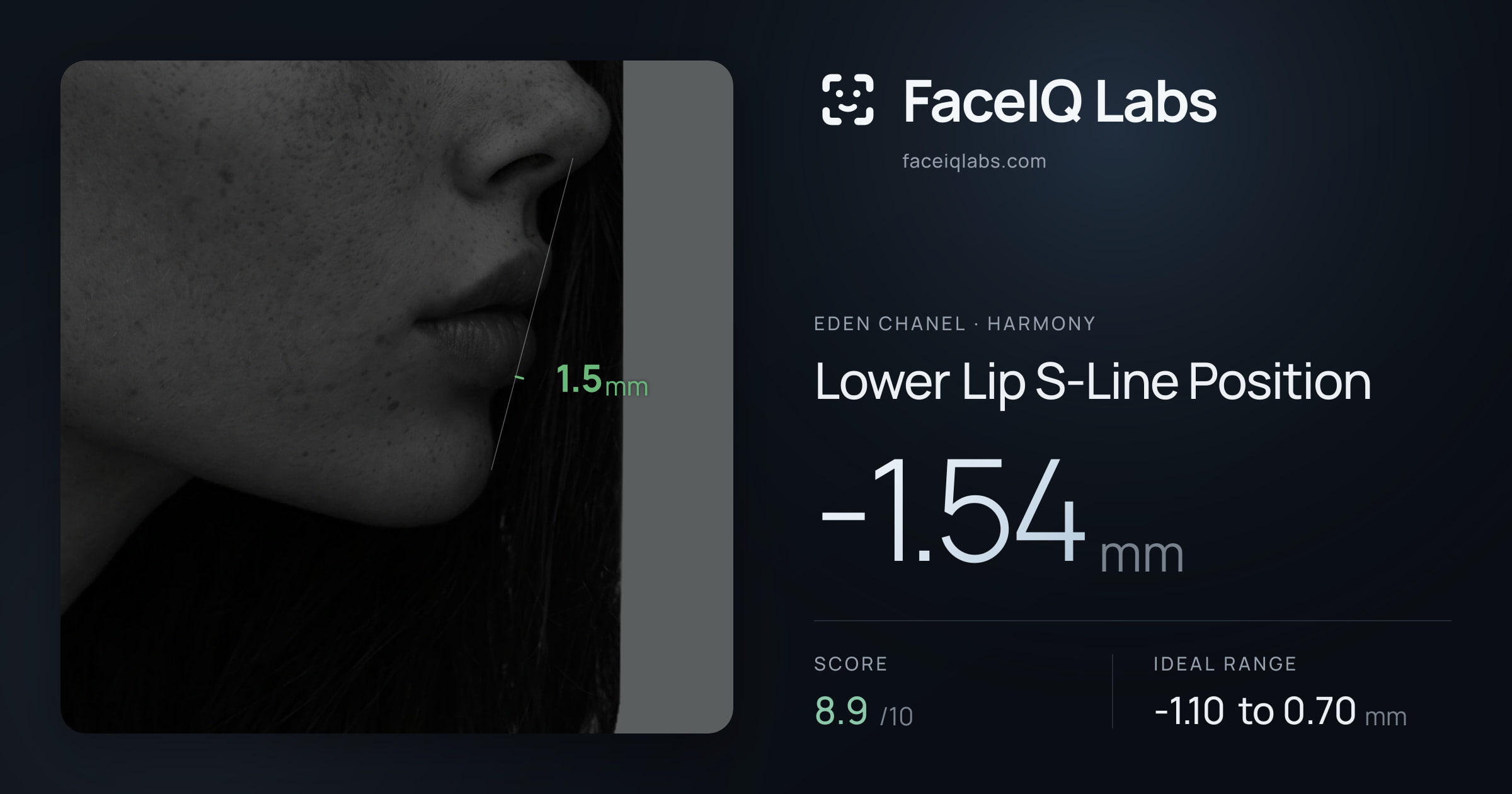 Eden Chanel Lower Lip S-Line Position: -1.54mm, drawn on the photo