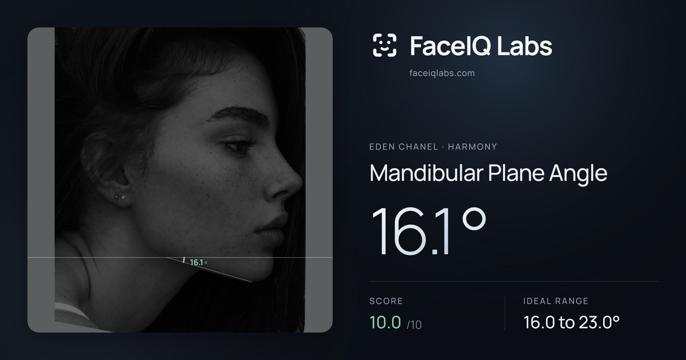 Eden Chanel Mandibular Plane Angle: 16.1°, drawn on the photo