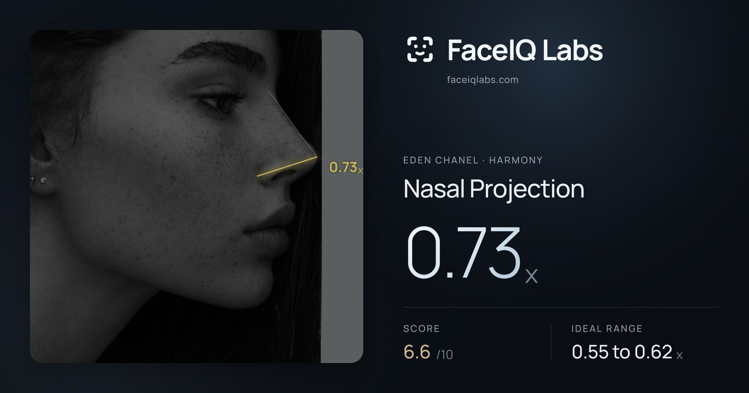 Eden Chanel Nasal Projection: 0.73x, drawn on the photo