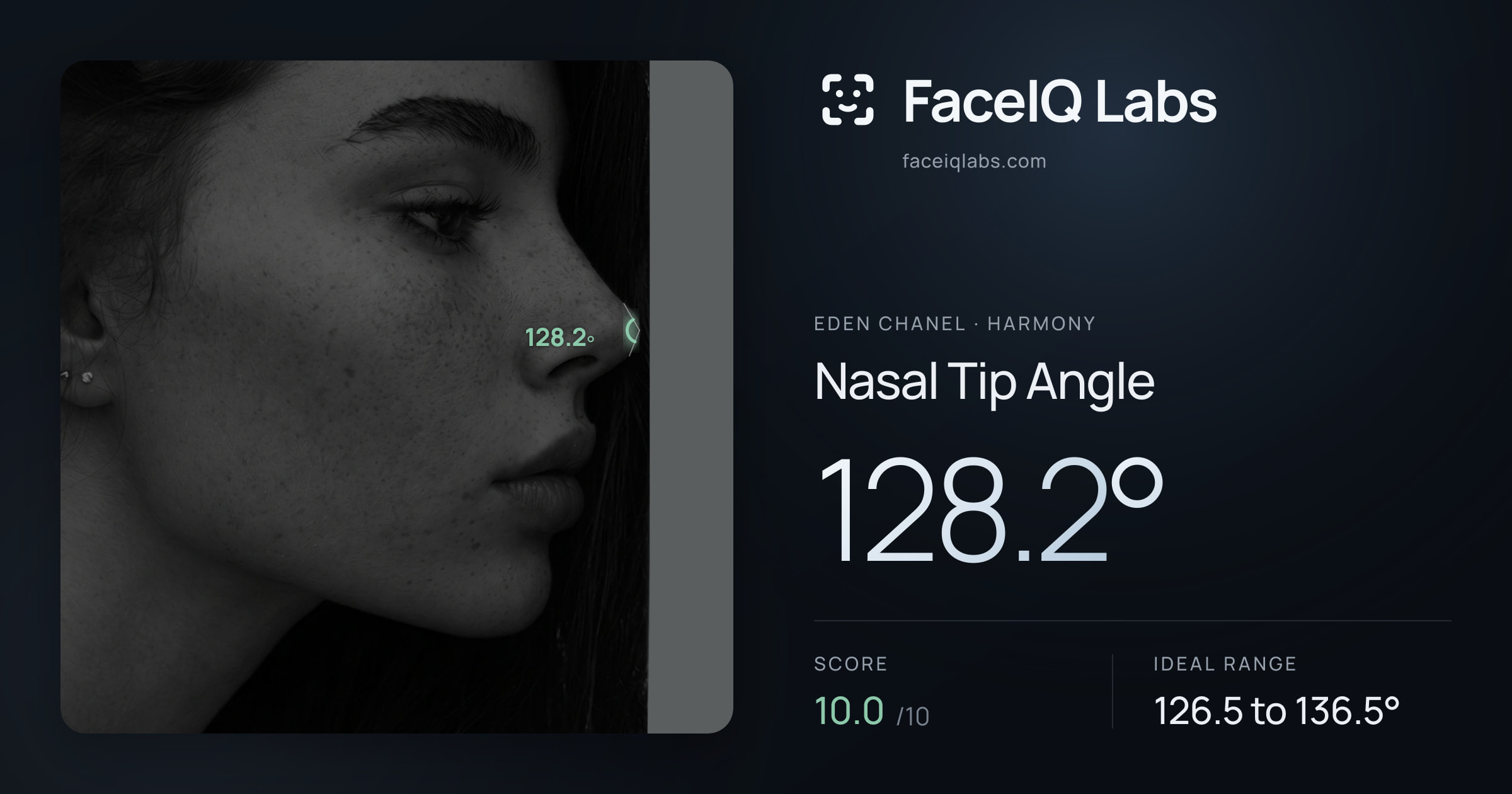 Eden Chanel Nasal Tip Angle: 128.2°, drawn on the photo