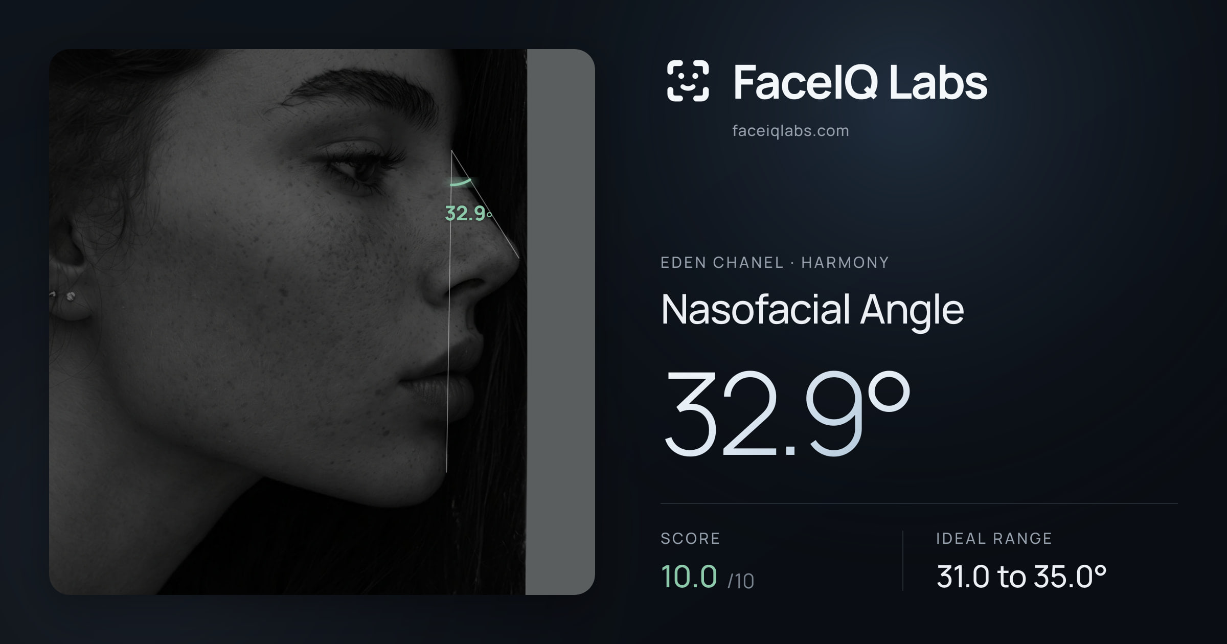Eden Chanel Nasofacial Angle: 32.9°, drawn on the photo
