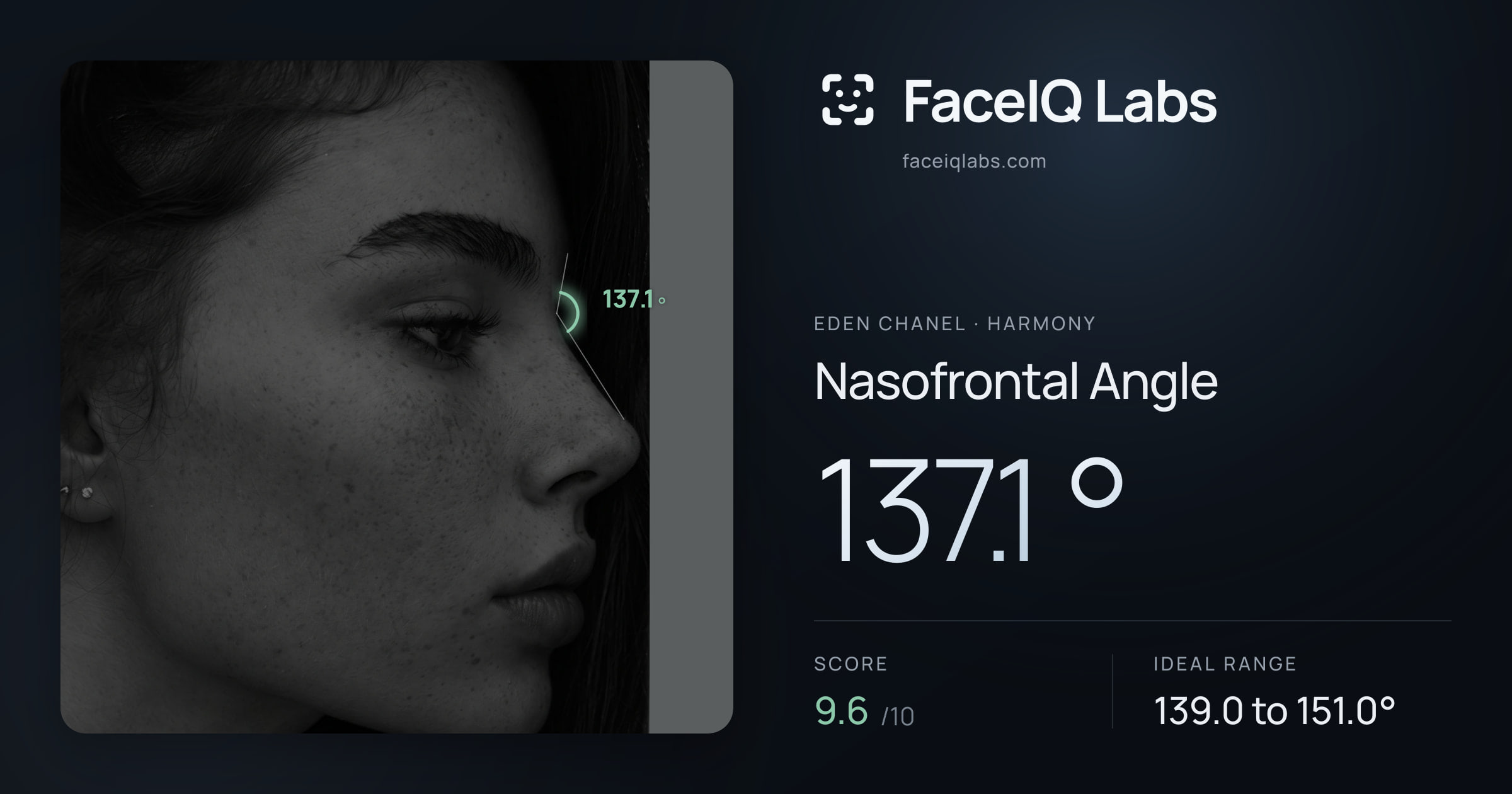 Eden Chanel Nasofrontal Angle: 137.1°, drawn on the photo