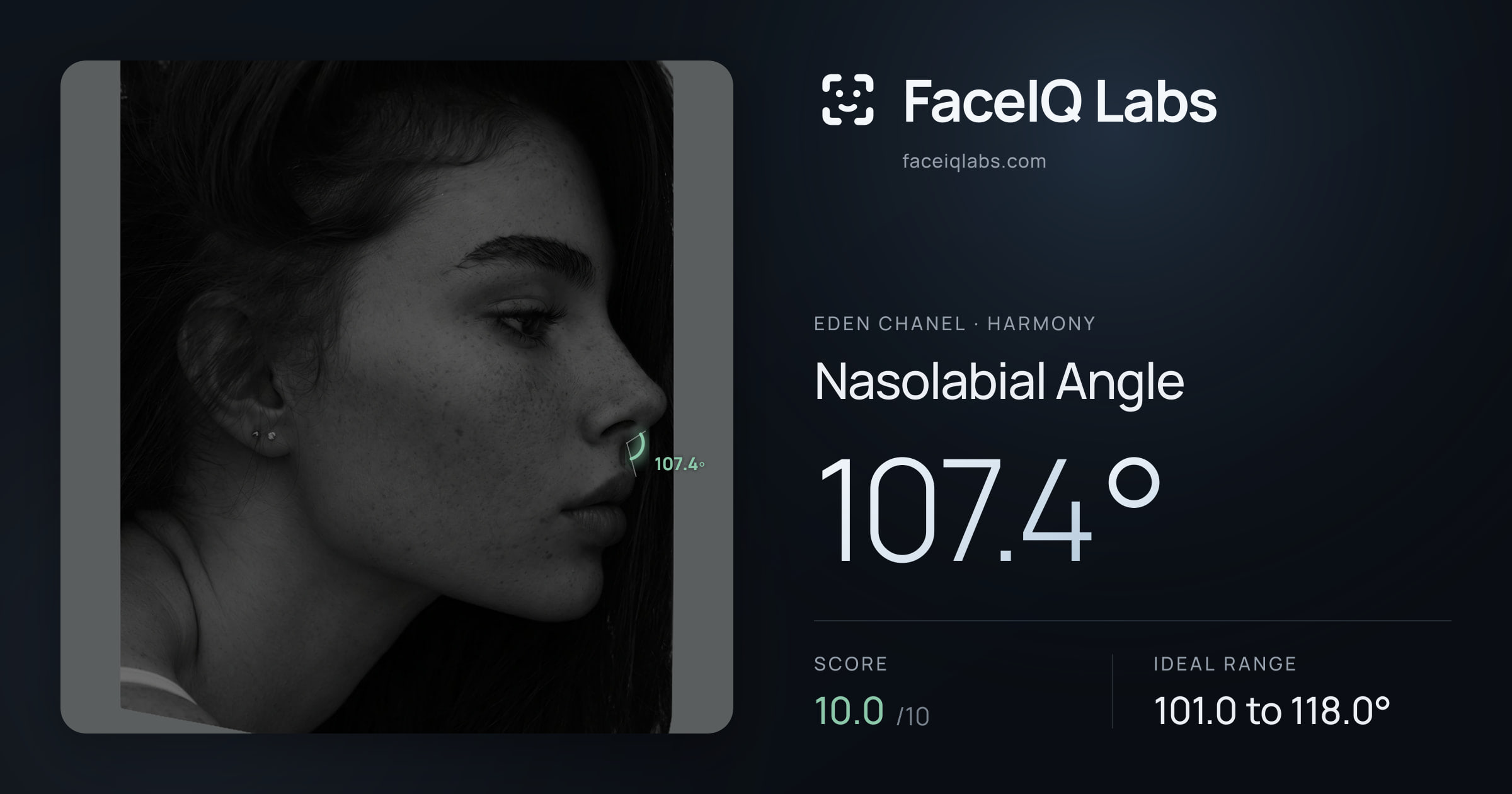 Eden Chanel Nasolabial Angle: 107.4°, drawn on the photo