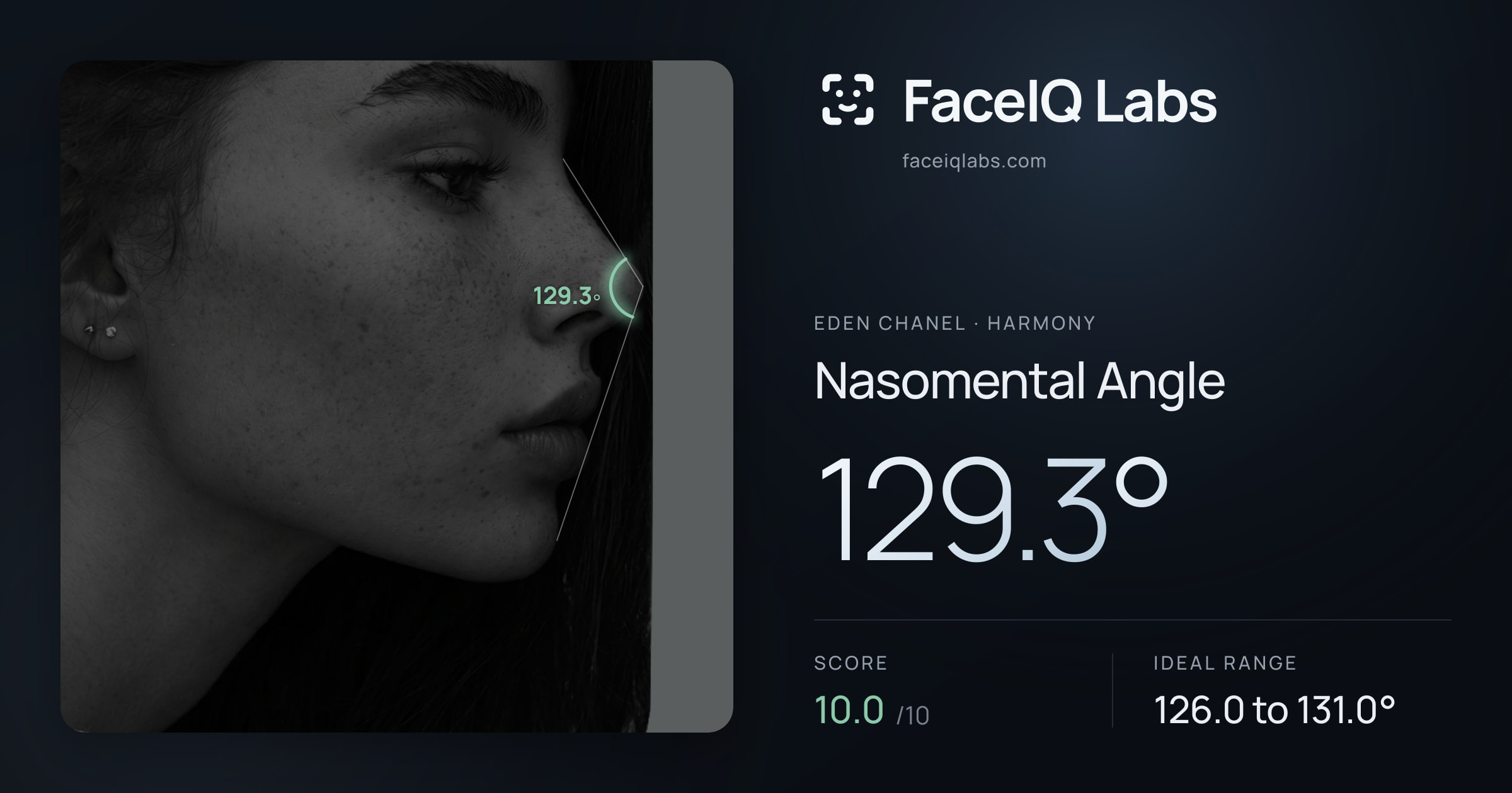 Eden Chanel Nasomental Angle: 129.3°, drawn on the photo