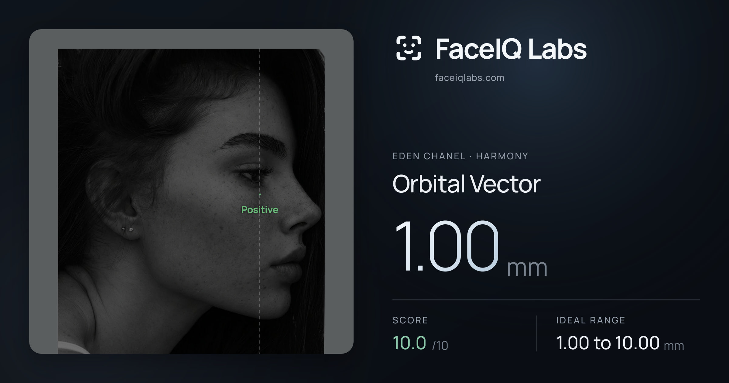 Eden Chanel Orbital Vector: 1.00mm, drawn on the photo
