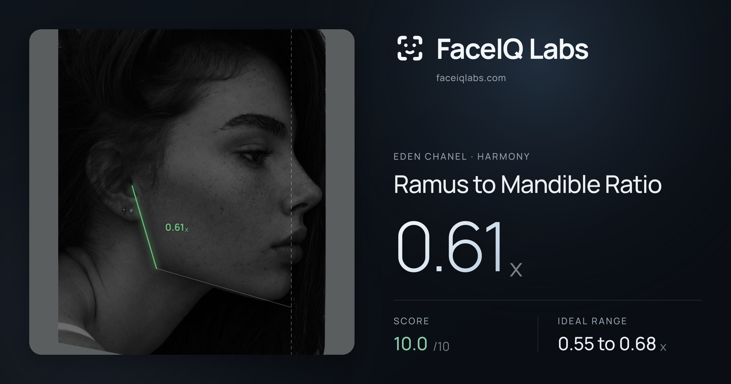 Eden Chanel Ramus to Mandible Ratio: 0.61x, drawn on the photo