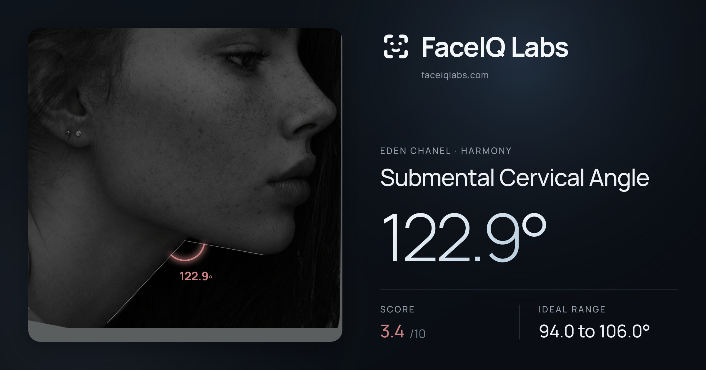 Eden Chanel Submental Cervical Angle: 122.9°, drawn on the photo
