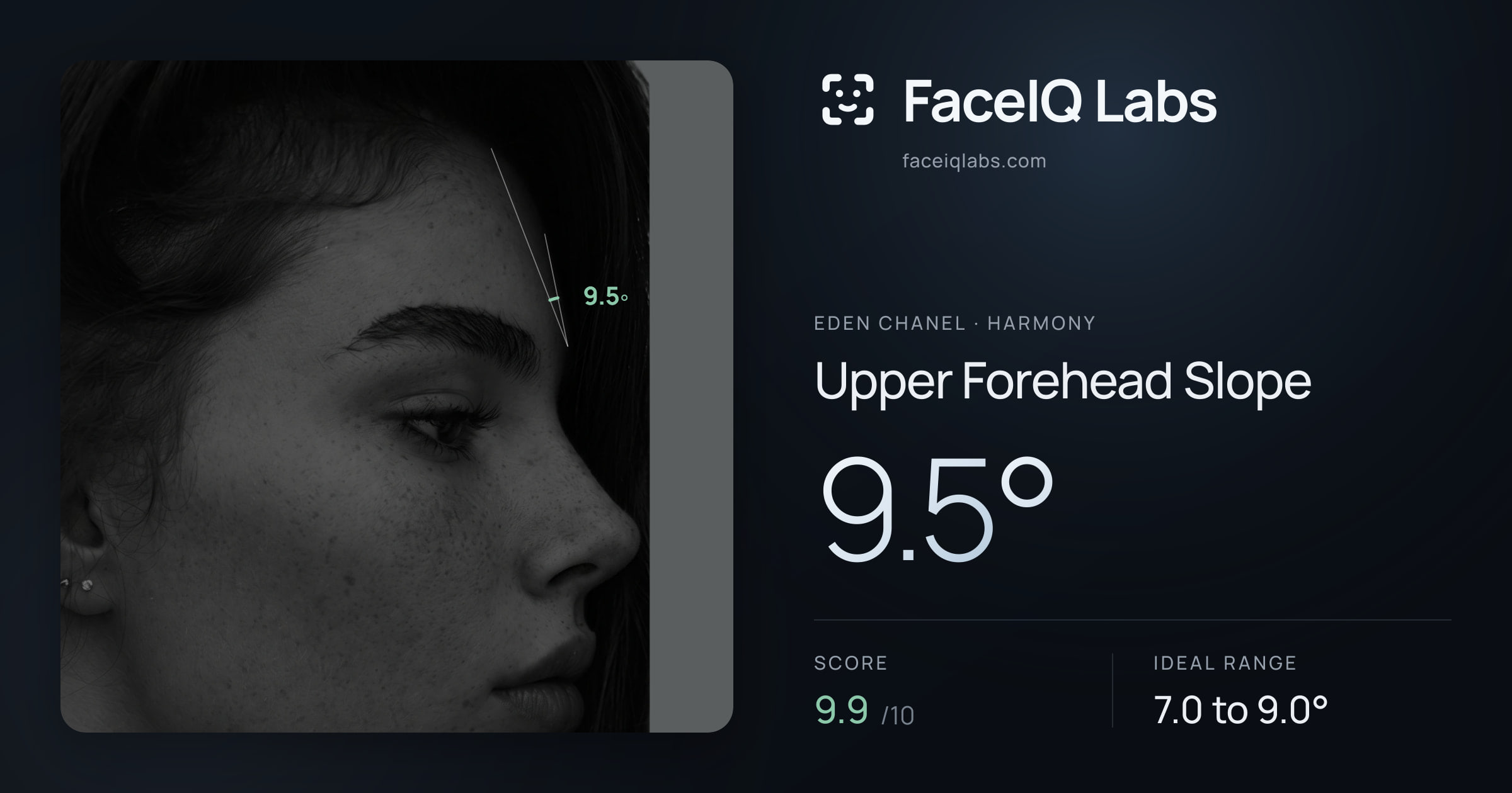 Eden Chanel Upper Forehead Slope: 9.5°, drawn on the photo