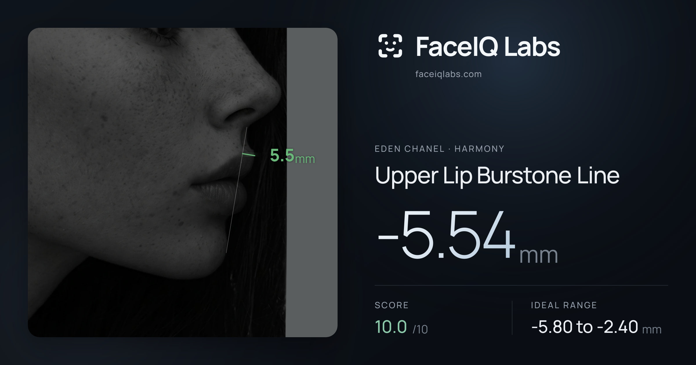 Eden Chanel Upper Lip Burstone Line: -5.54mm, drawn on the photo