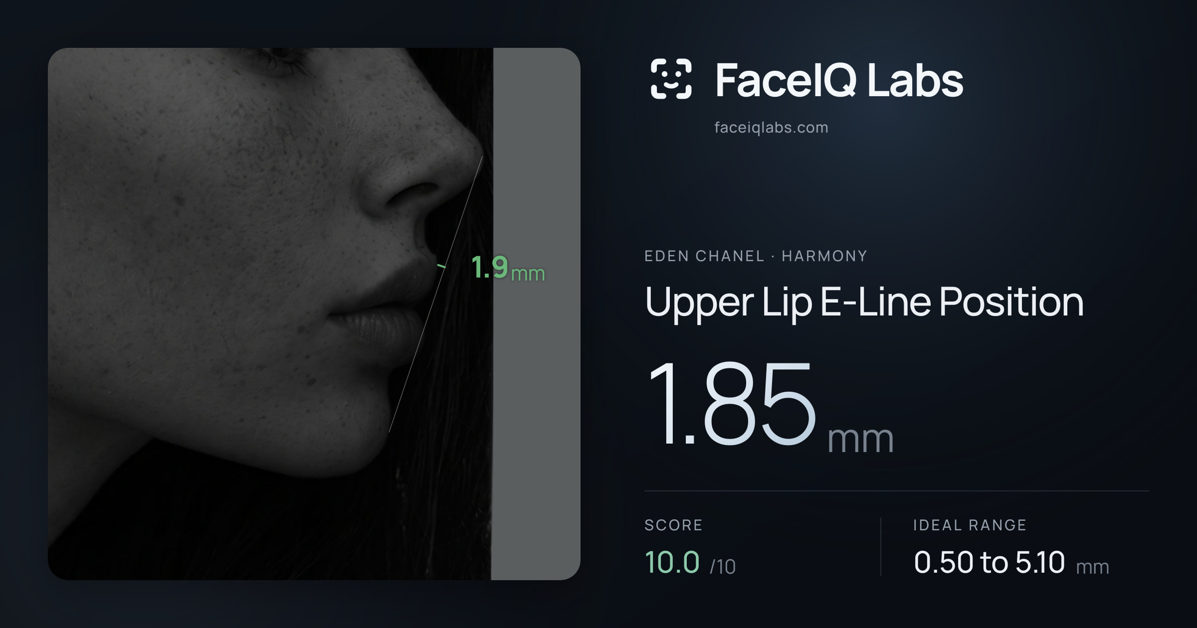Eden Chanel Upper Lip E-Line Position: 1.85mm, drawn on the photo