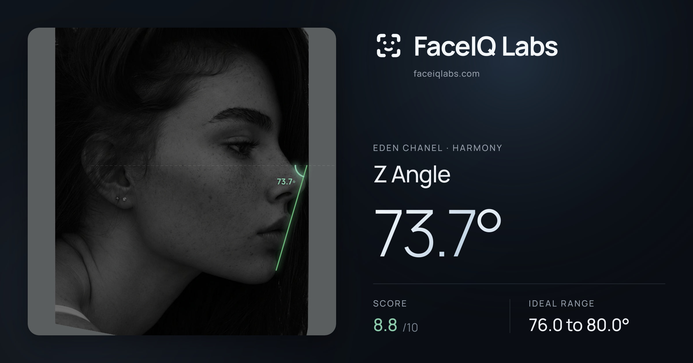 Eden Chanel Z Angle: 73.7°, drawn on the photo