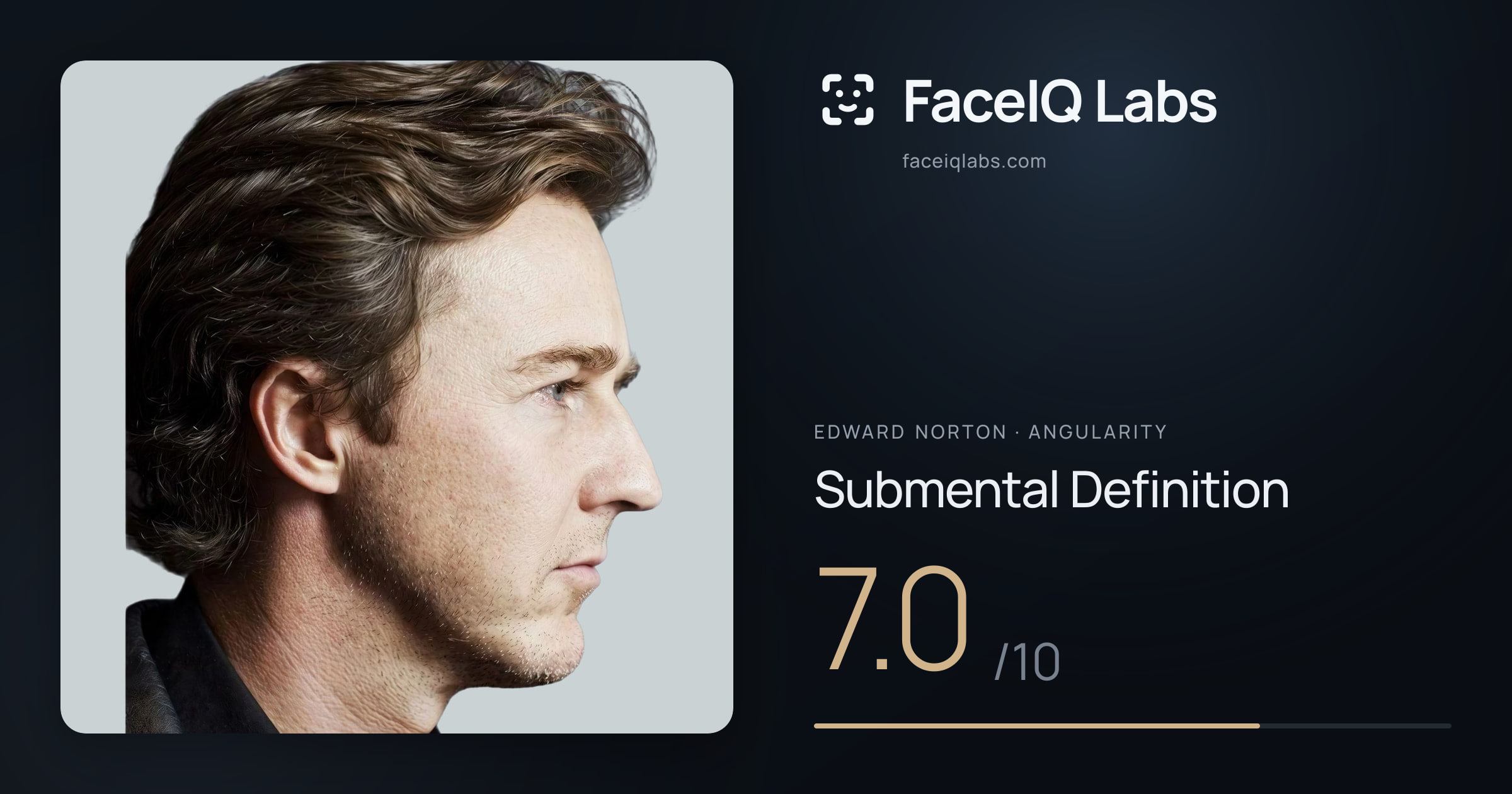 Edward Norton Submental Definition: 7.0/10, drawn on the photo