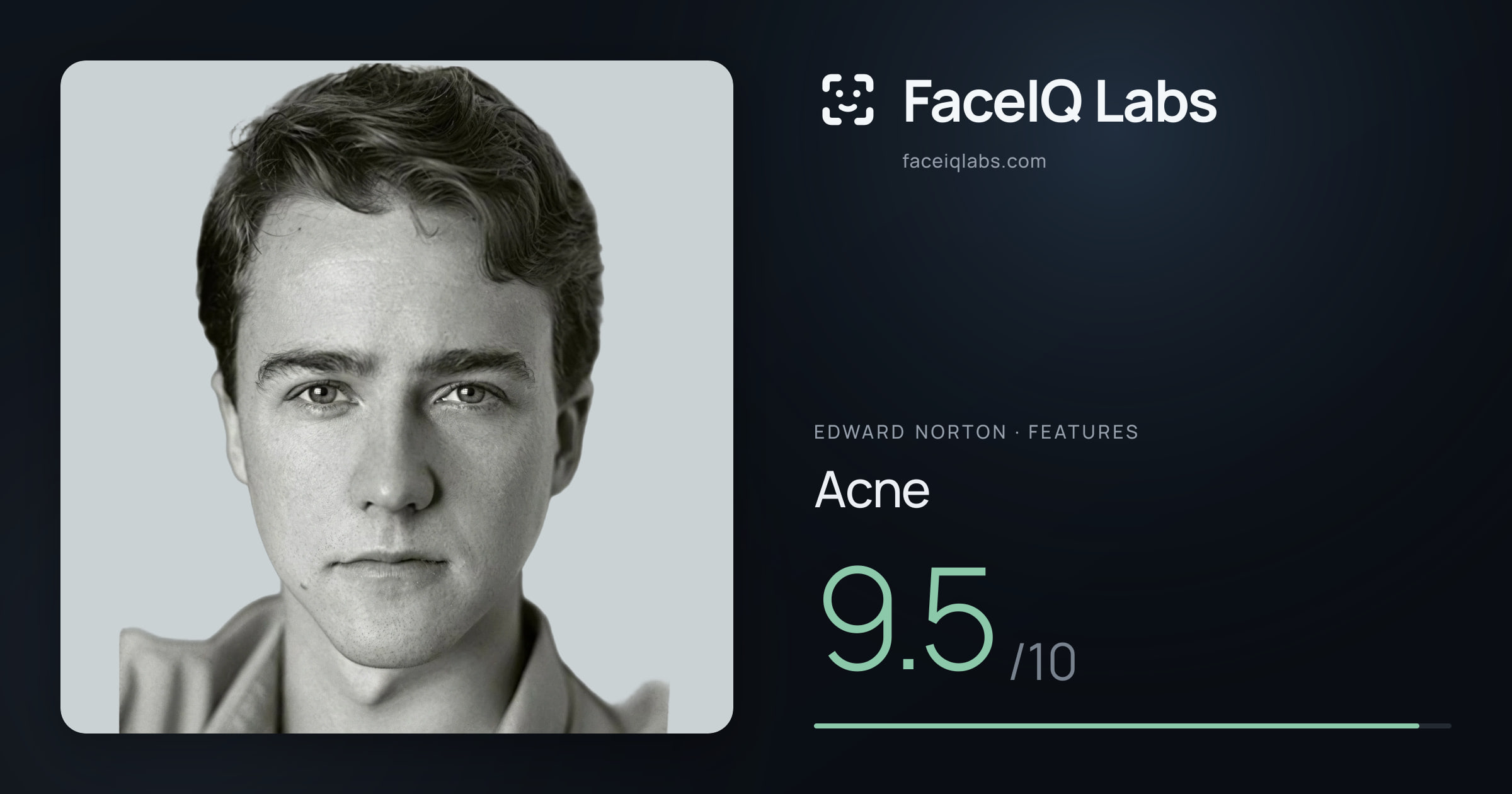 Edward Norton Acne: 9.5/10, drawn on the photo