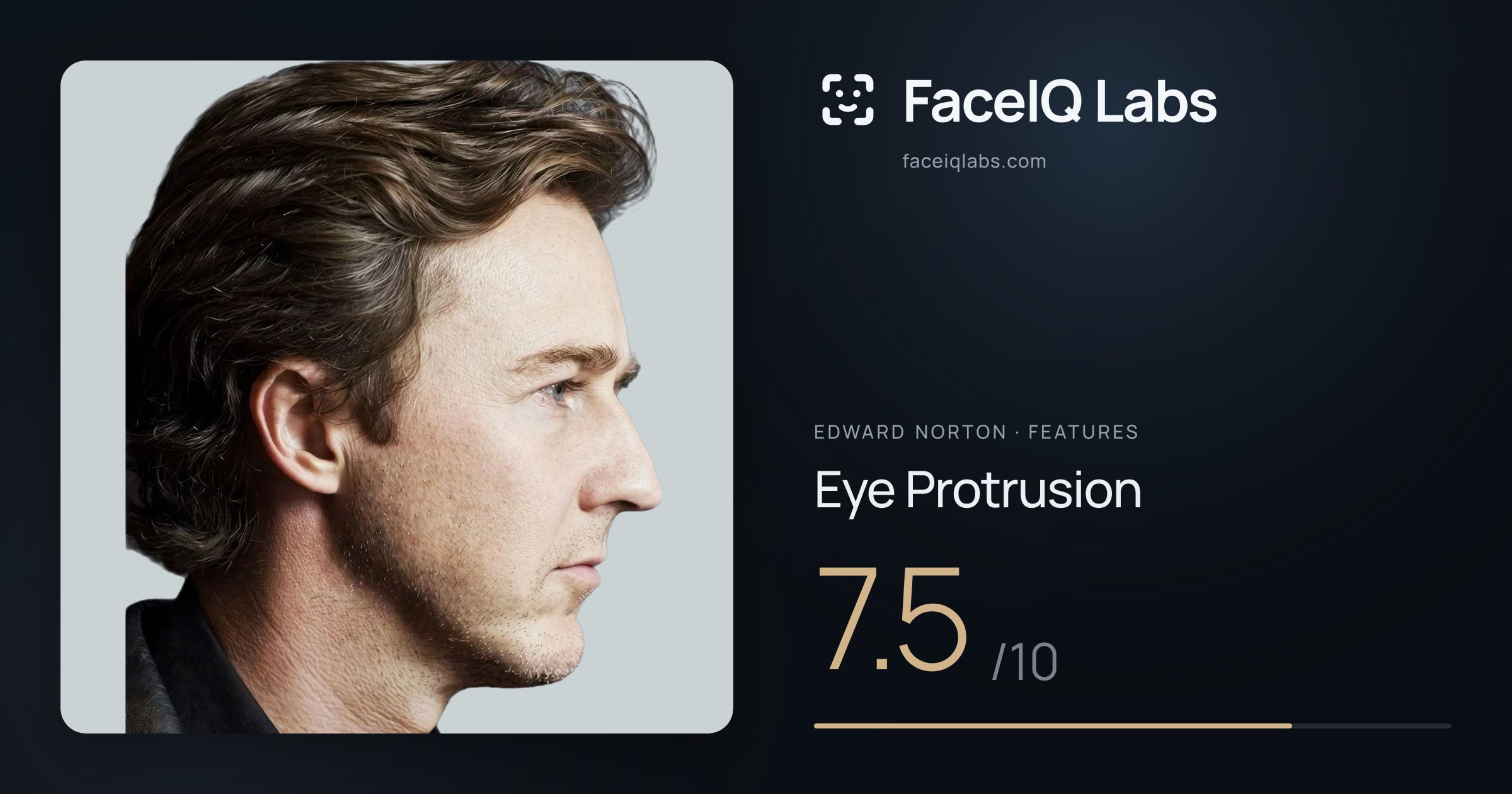 Edward Norton Eye Protrusion: 7.5/10, drawn on the photo