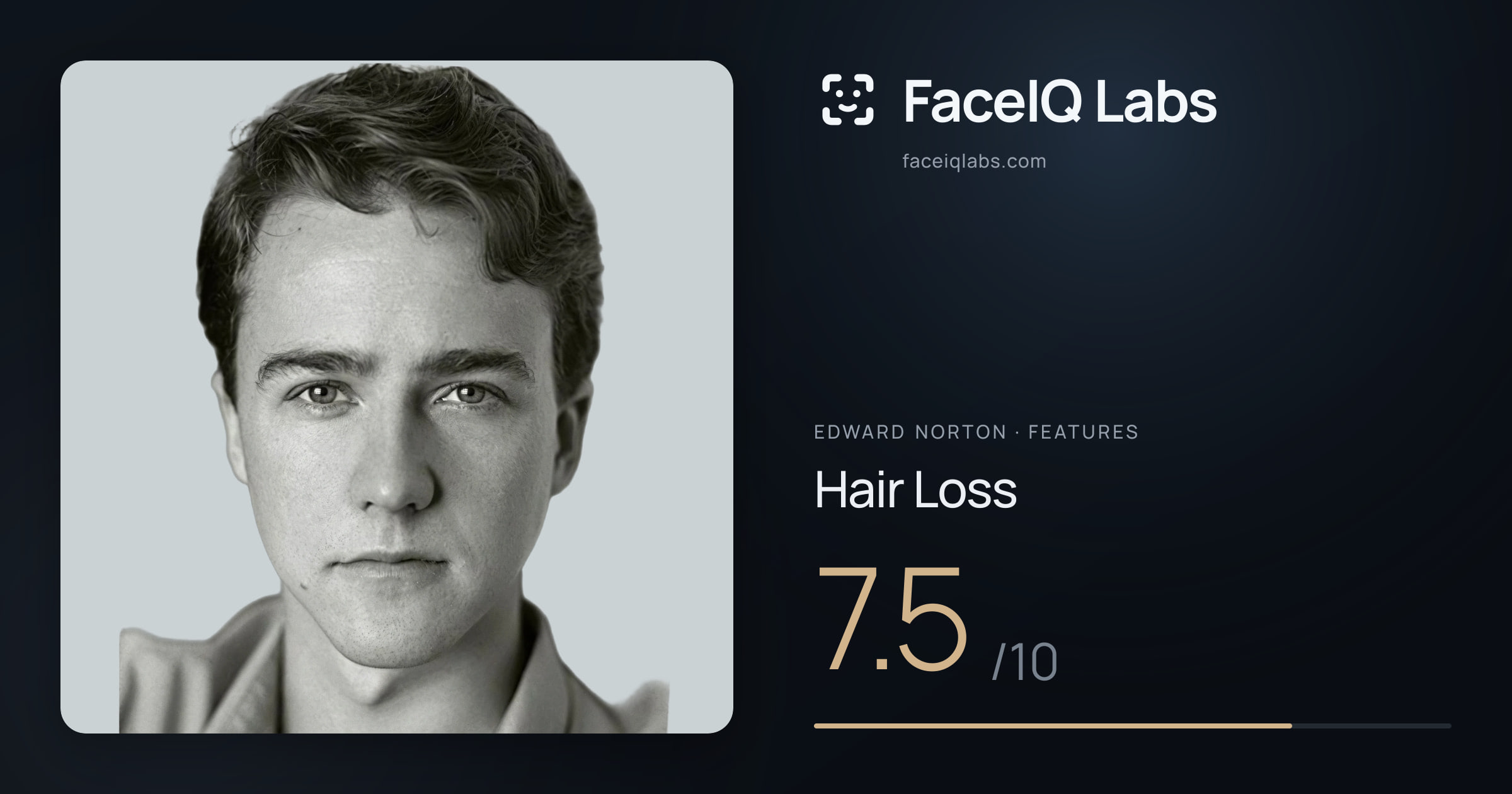 Edward Norton Hair Loss: 7.5/10, drawn on the photo