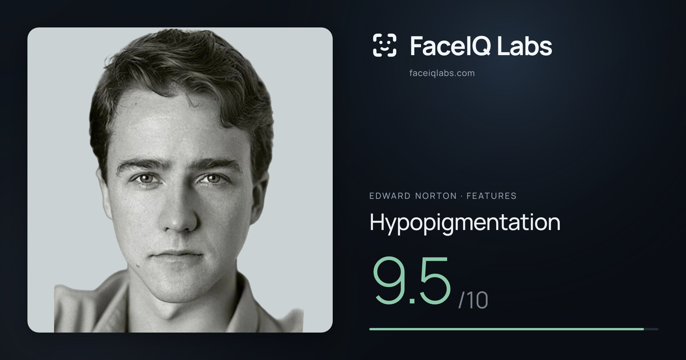 Edward Norton Hypopigmentation: 9.5/10, drawn on the photo