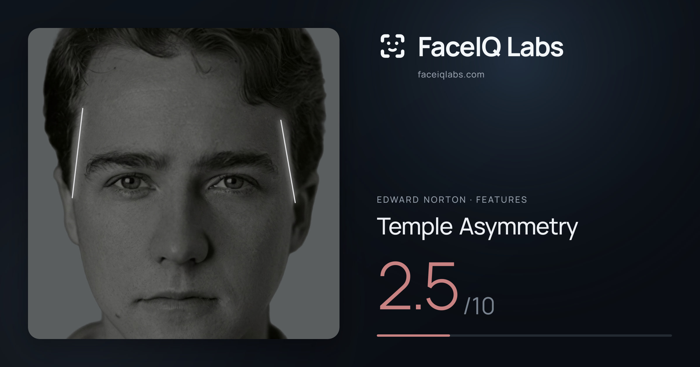 Edward Norton Temple Asymmetry: 2.5/10, drawn on the photo