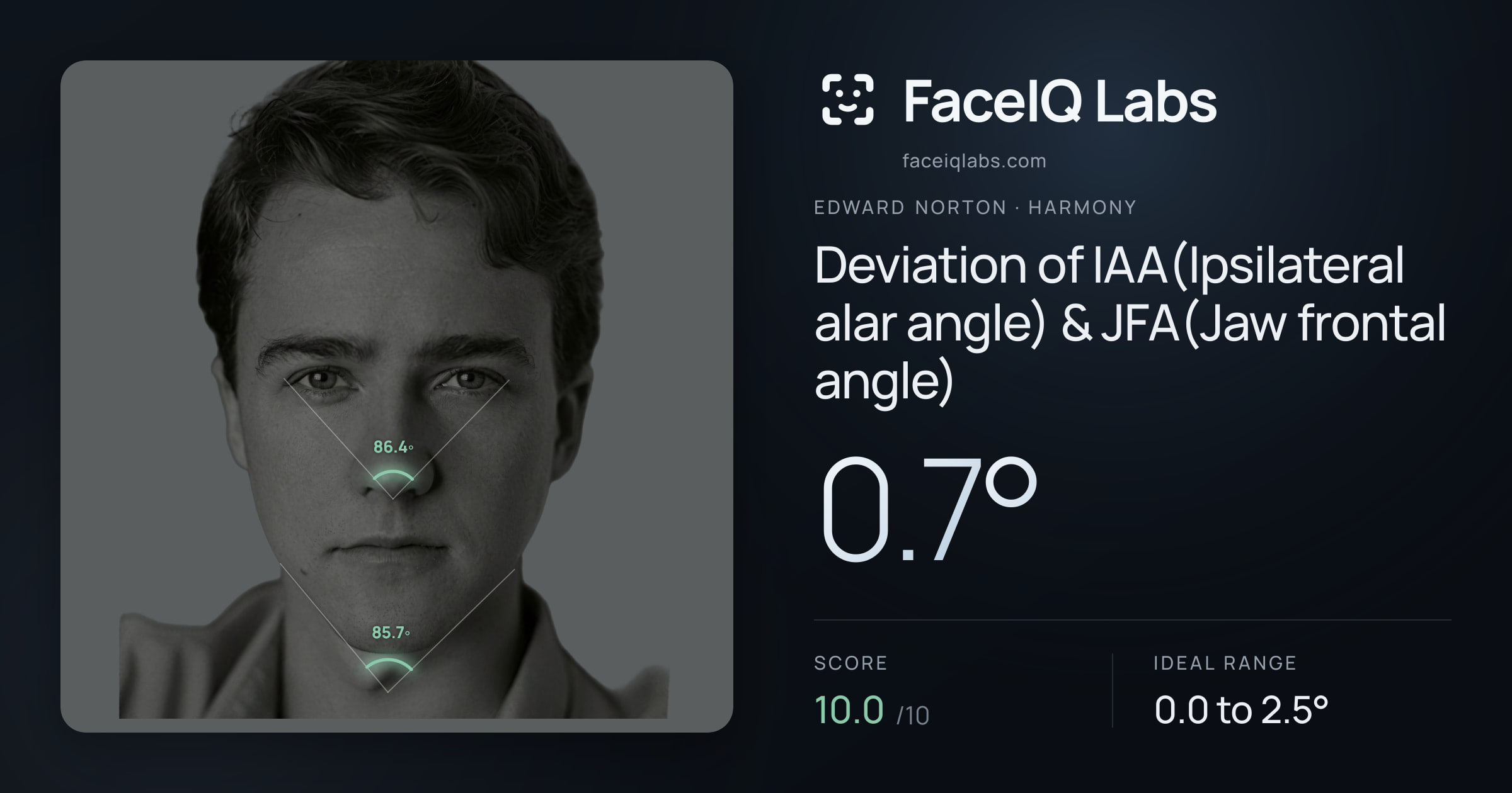 Edward Norton Deviation of IAA(Ipsilateral alar angle) & JFA(Jaw frontal angle): 0.7°, drawn on the photo