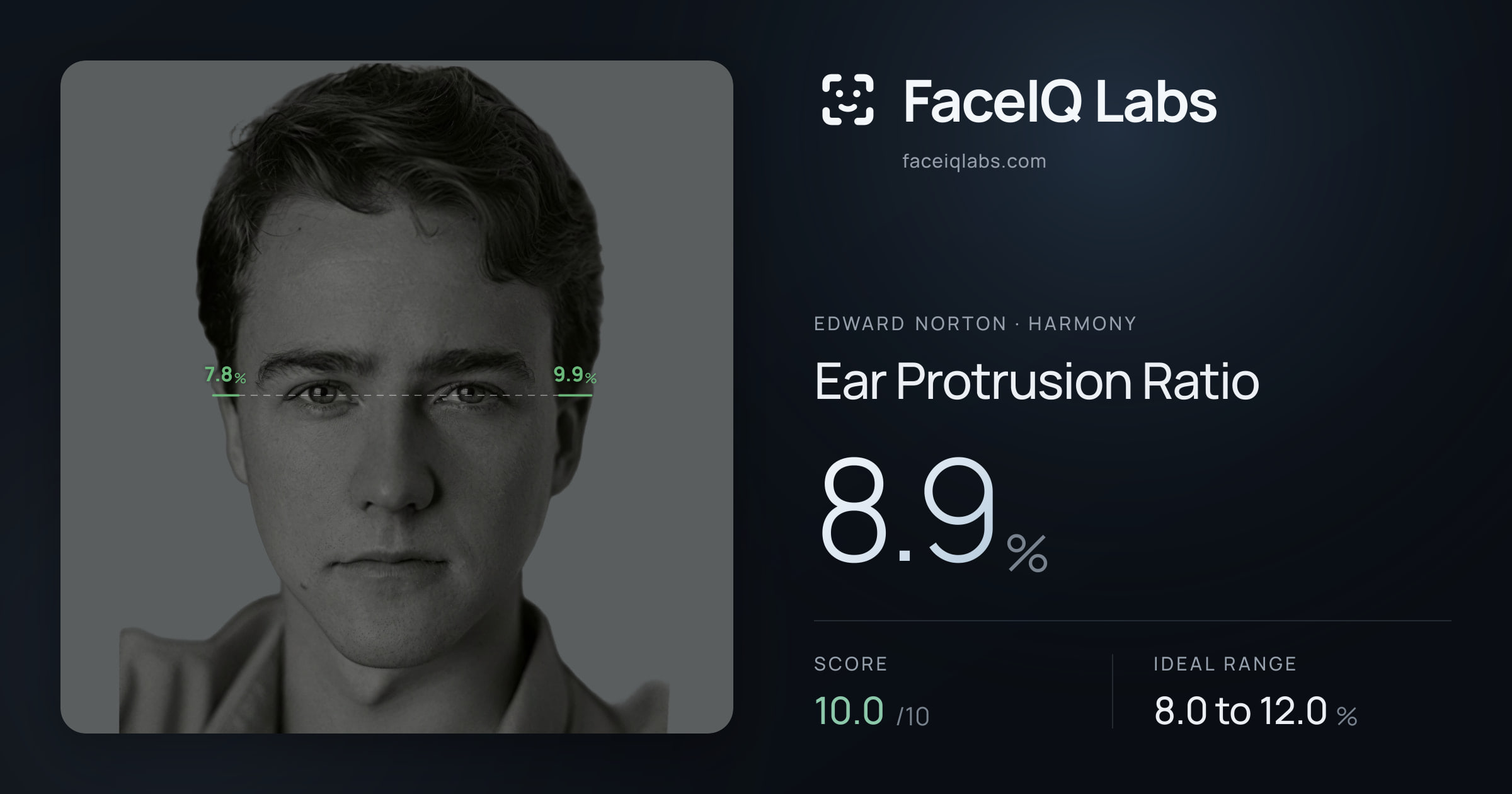 Edward Norton Ear Protrusion Ratio: 8.9%, drawn on the photo