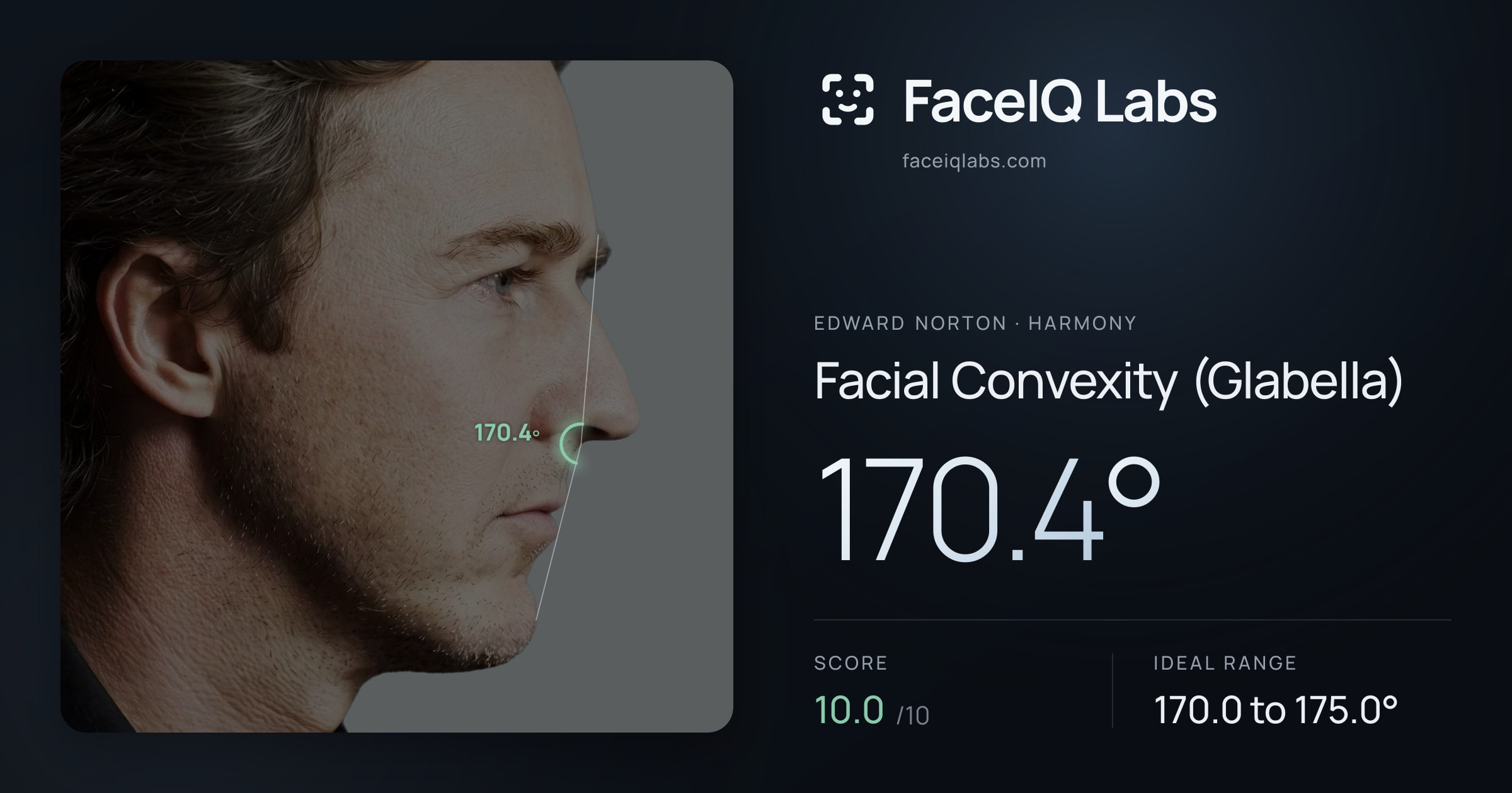 Edward Norton Facial Convexity (Glabella): 170.4°, drawn on the photo