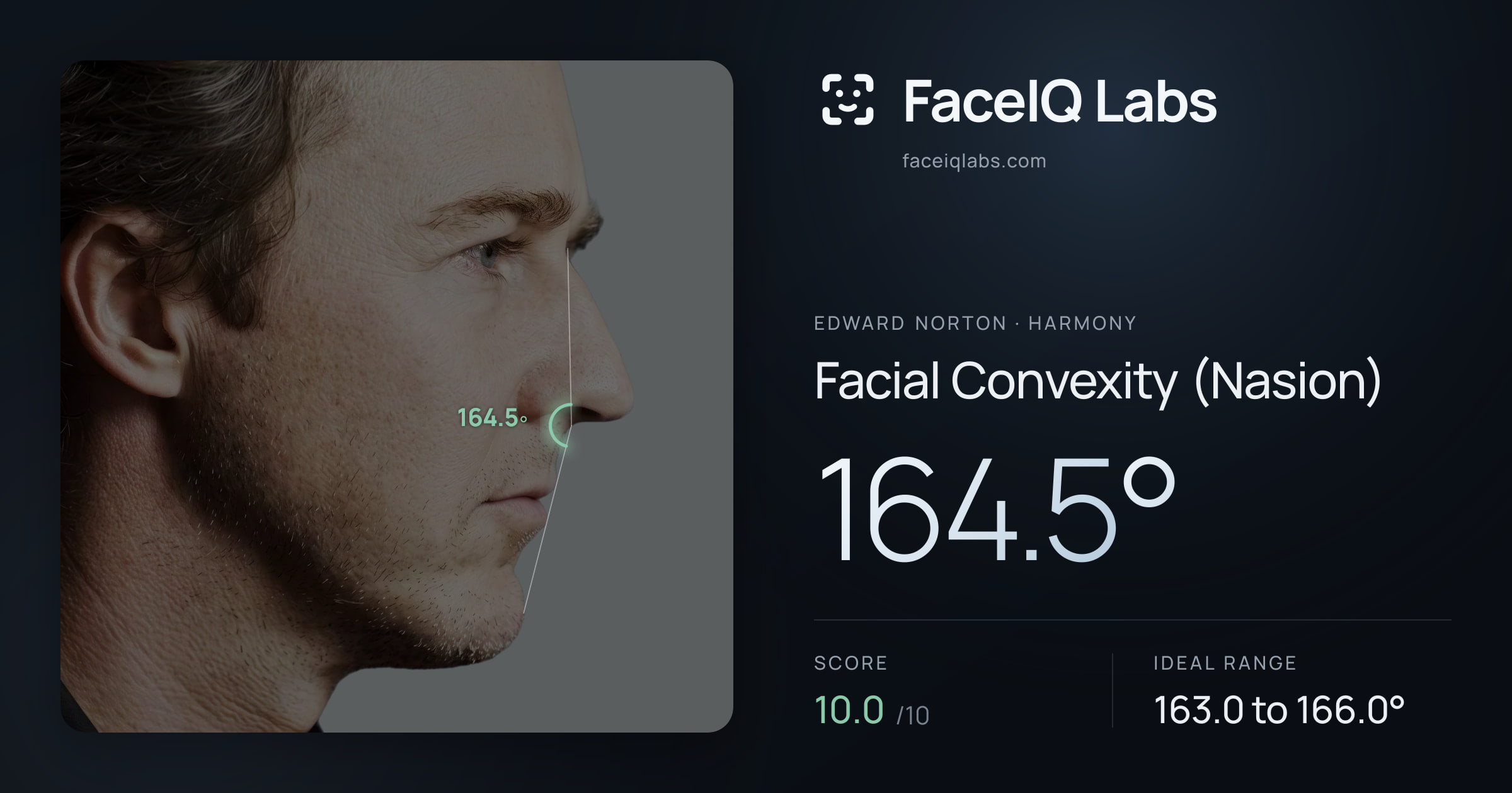 Edward Norton Facial Convexity (Nasion): 164.5°, drawn on the photo