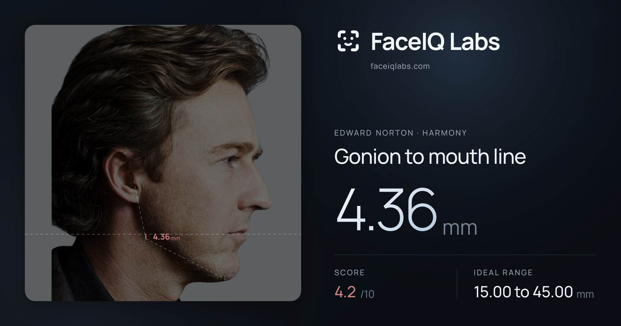 Edward Norton Gonion to mouth line: 4.36mm, drawn on the photo