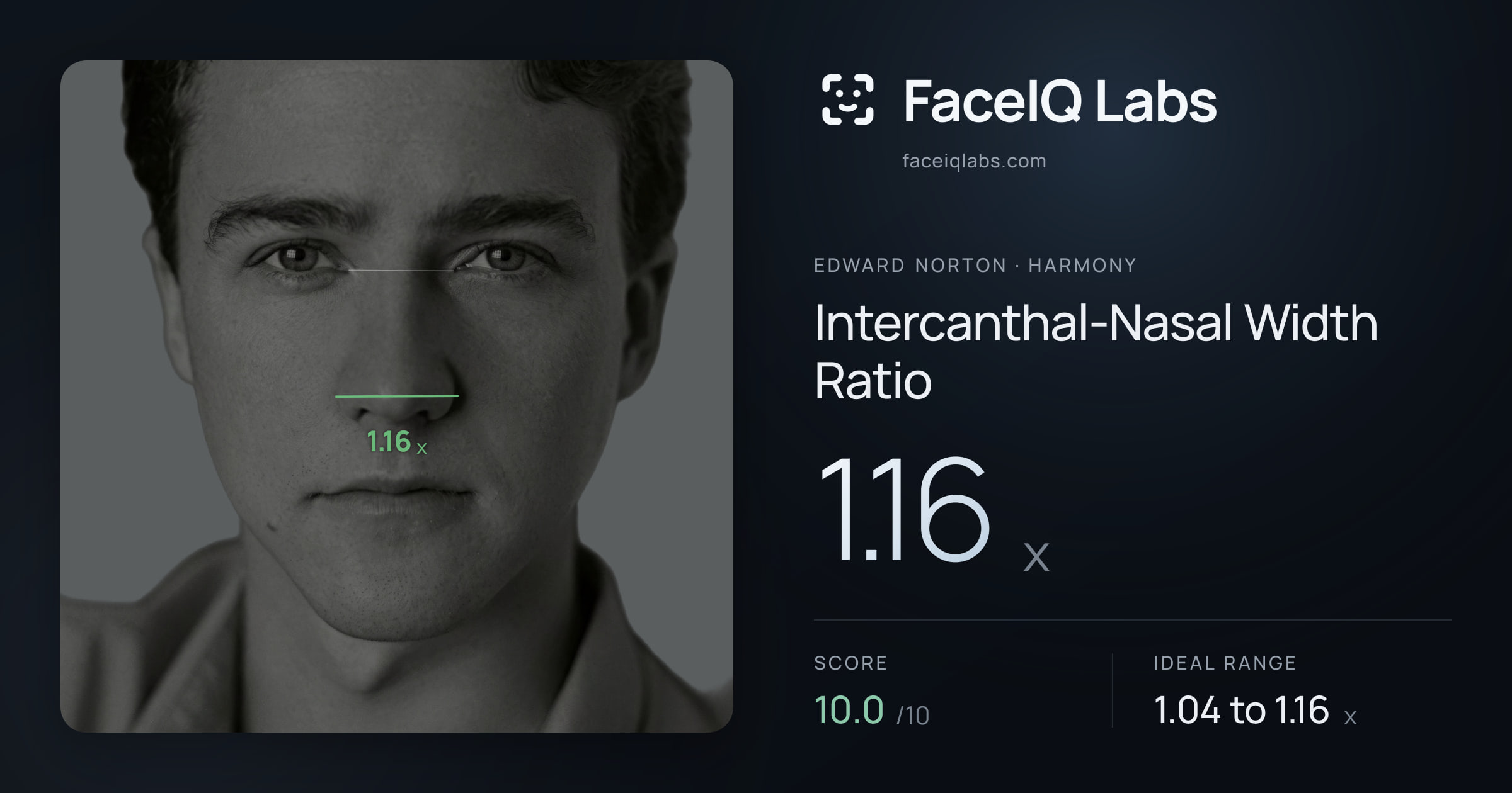 Edward Norton Intercanthal-Nasal Width Ratio: 1.16x, drawn on the photo