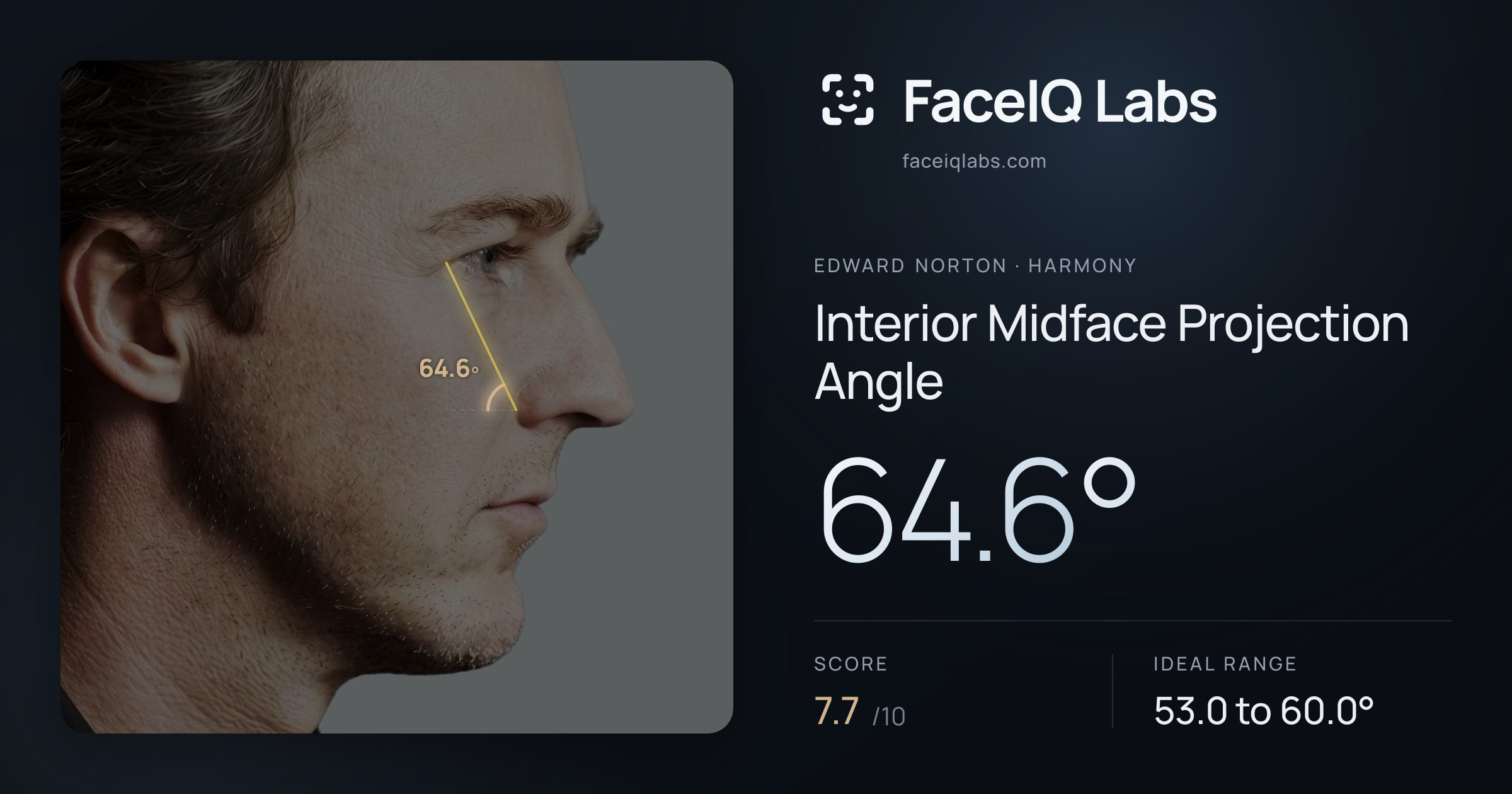 Edward Norton Interior Midface Projection Angle: 64.6°, drawn on the photo