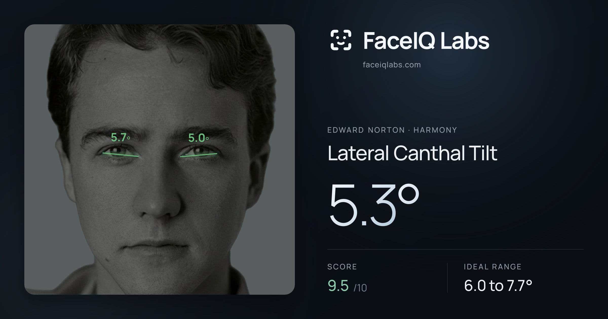 Edward Norton Lateral Canthal Tilt: 5.3°, drawn on the photo