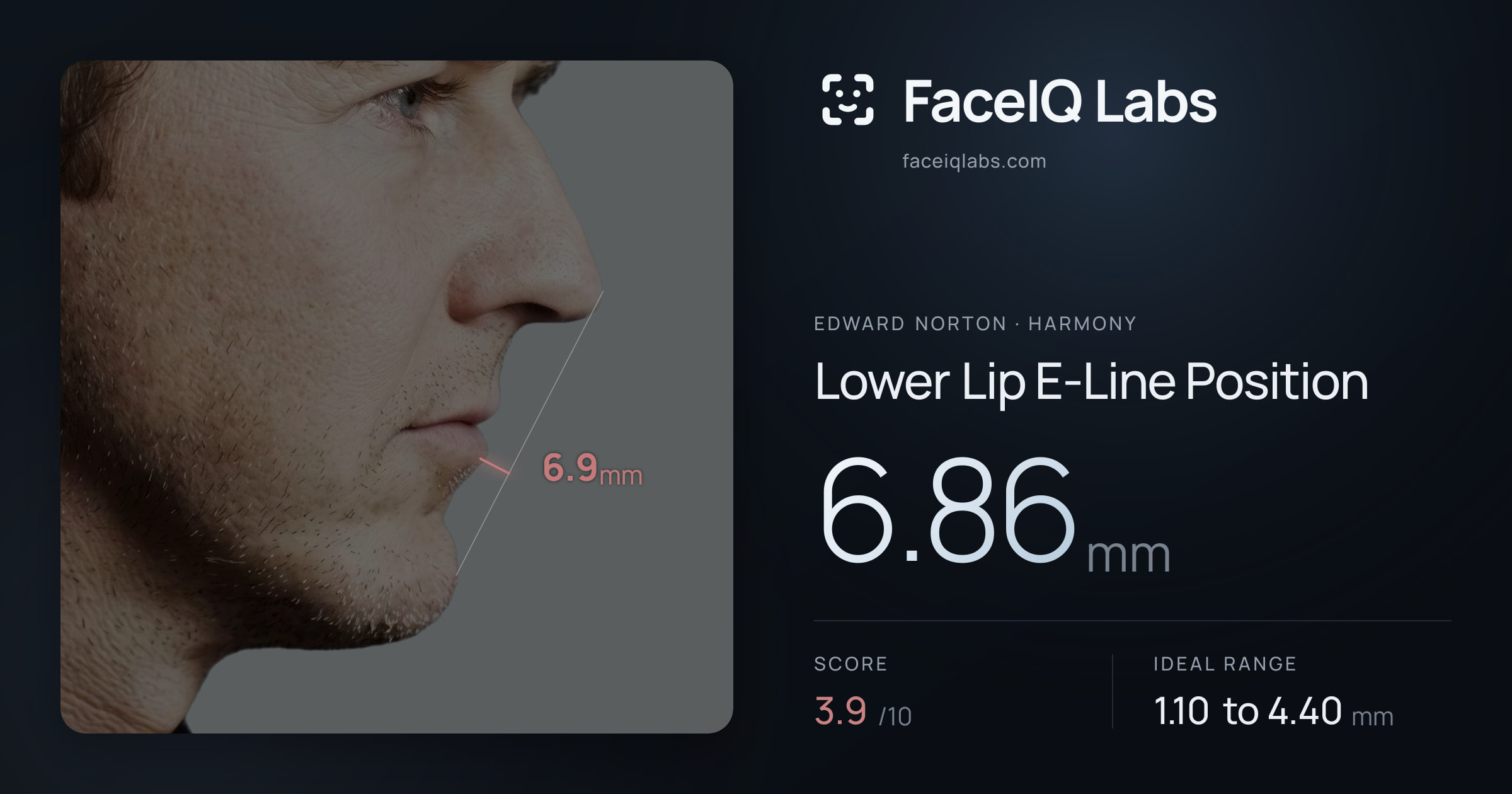 Edward Norton Lower Lip E-Line Position: 6.86mm, drawn on the photo