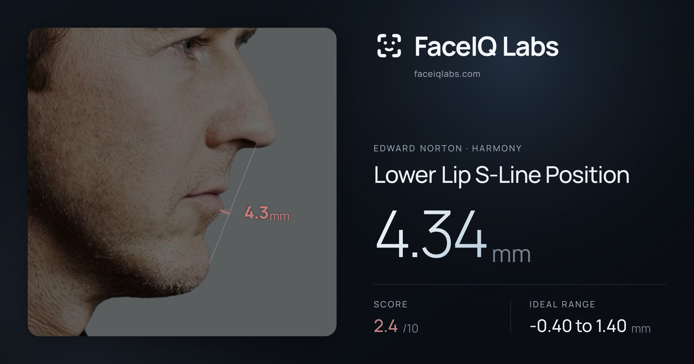 Edward Norton Lower Lip S-Line Position: 4.34mm, drawn on the photo