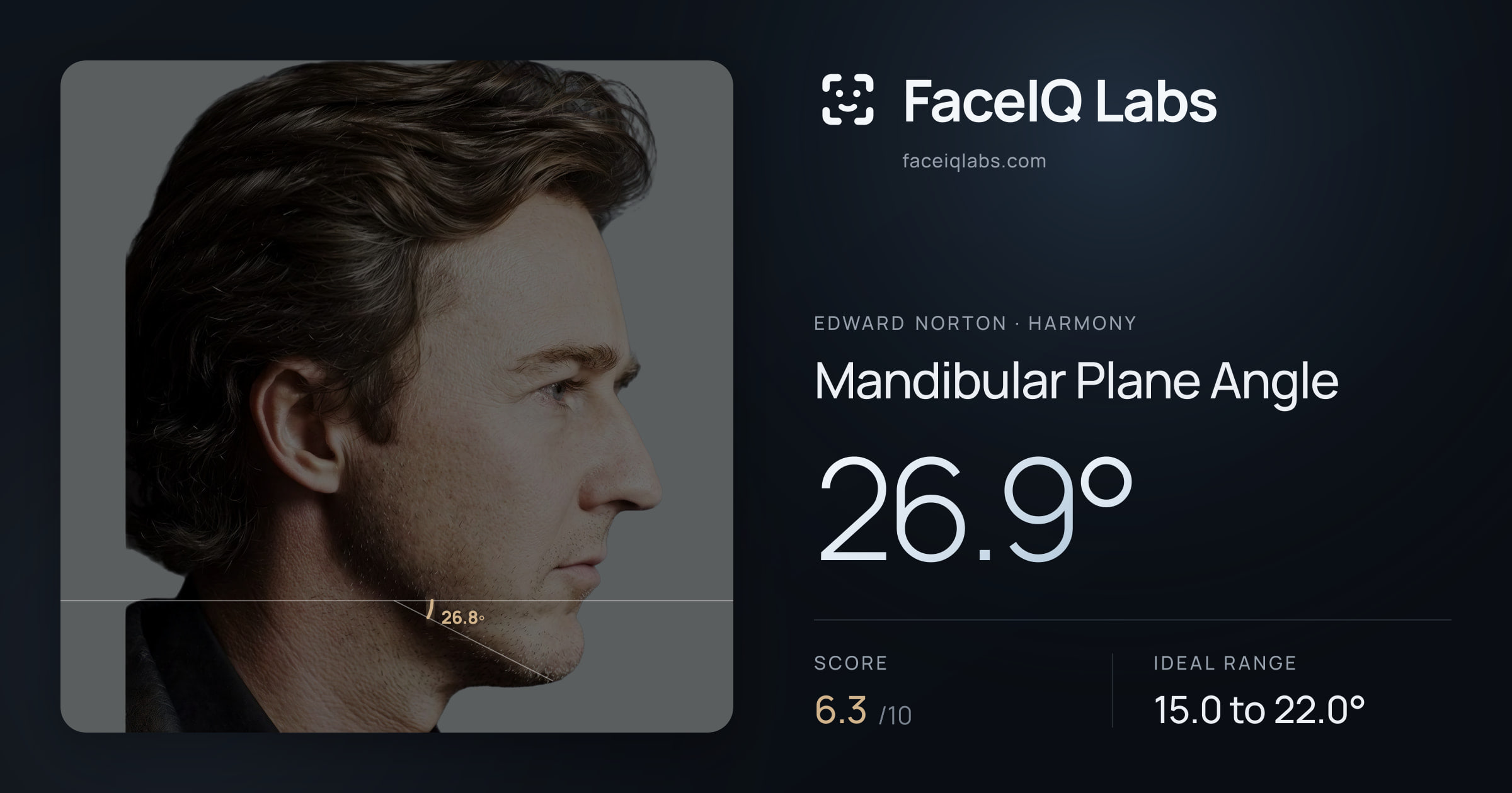 Edward Norton Mandibular Plane Angle: 26.9°, drawn on the photo
