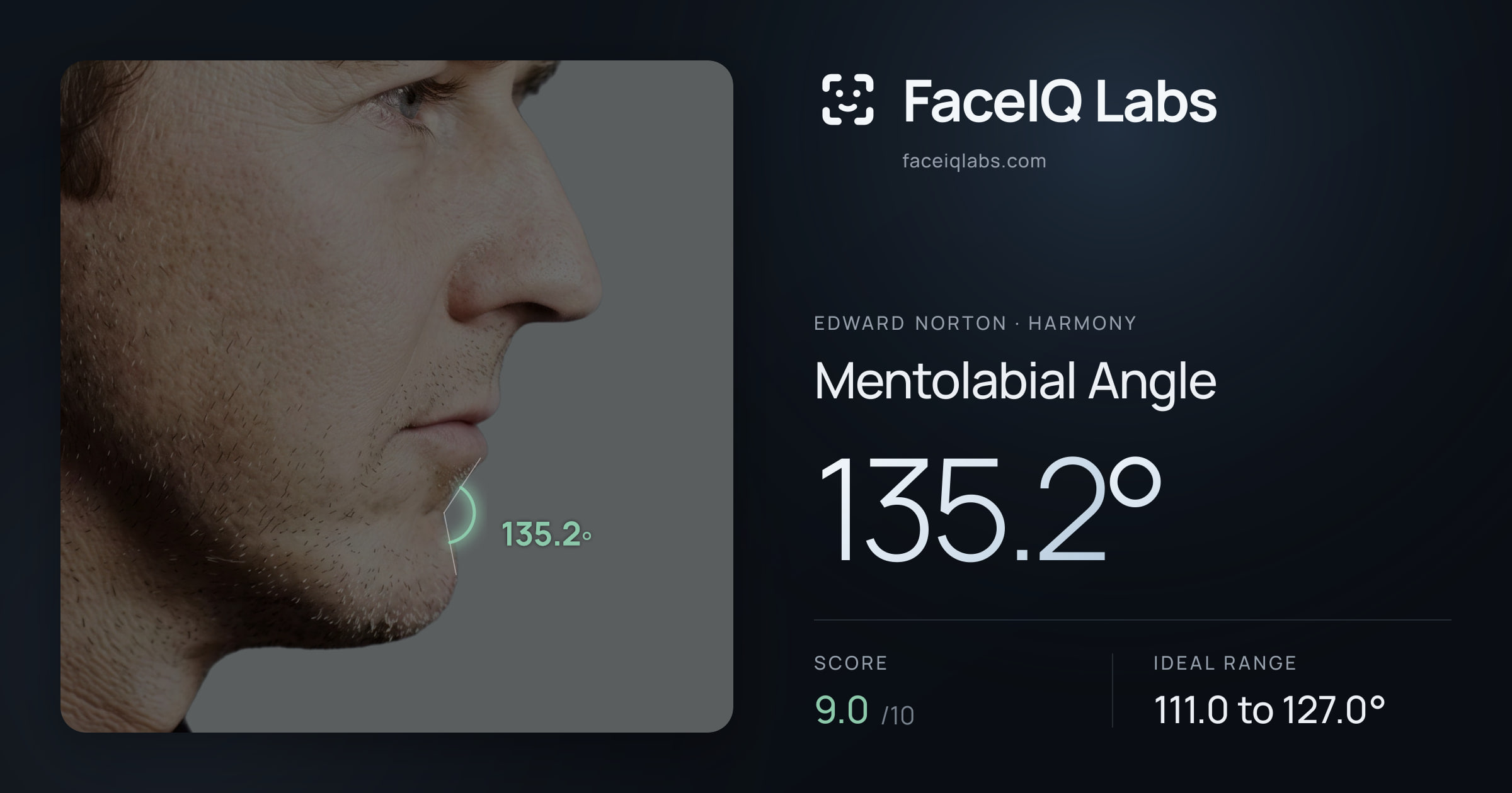 Edward Norton Mentolabial Angle: 135.2°, drawn on the photo