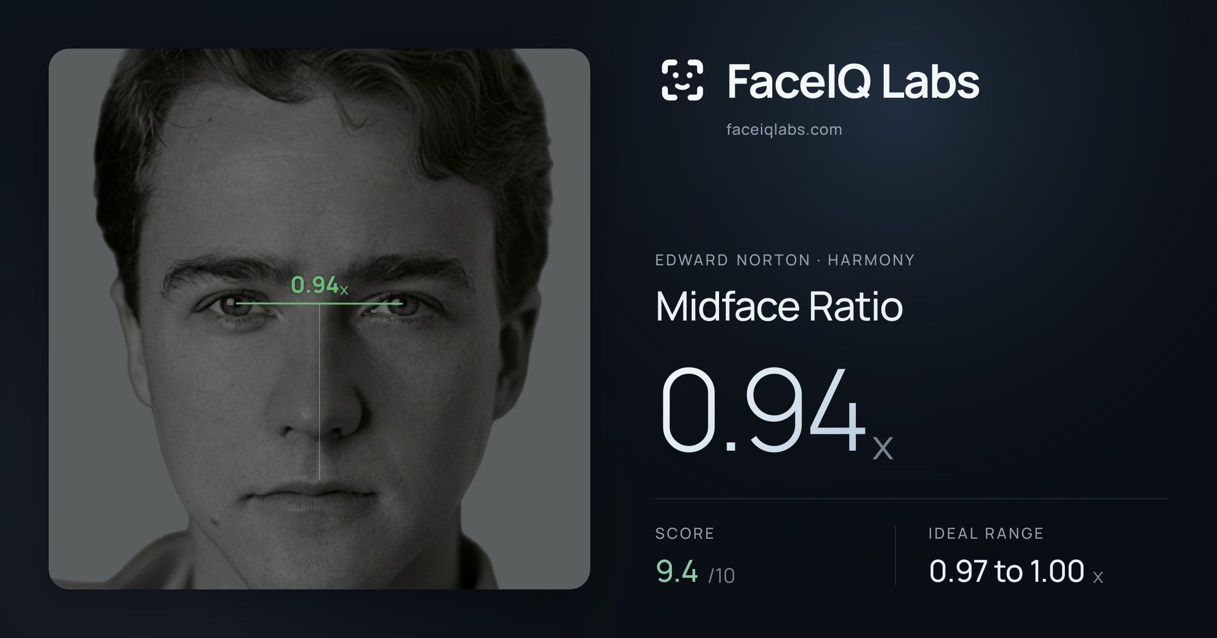 Edward Norton Midface Ratio: 0.94x, drawn on the photo
