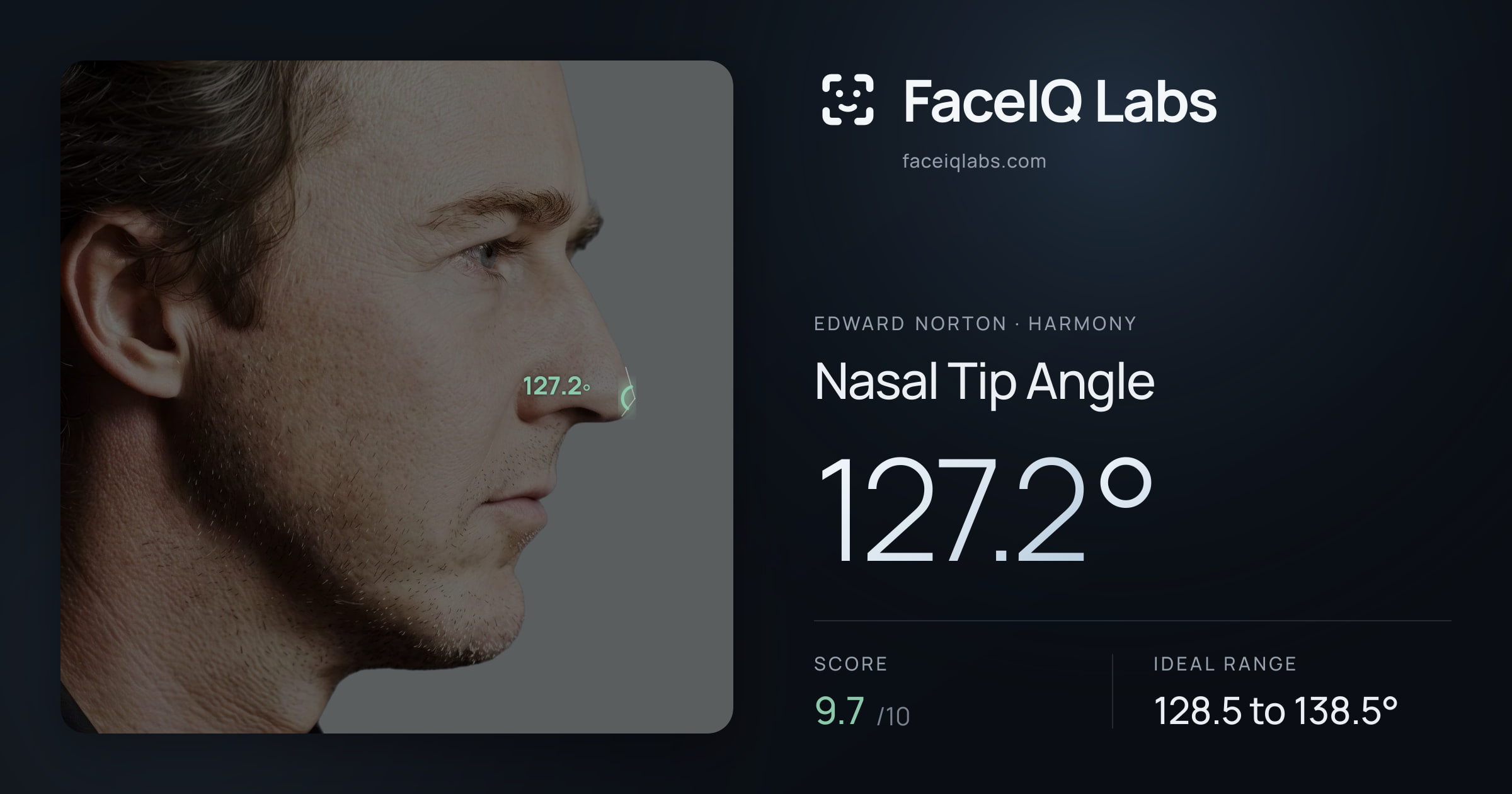 Edward Norton Nasal Tip Angle: 127.2°, drawn on the photo