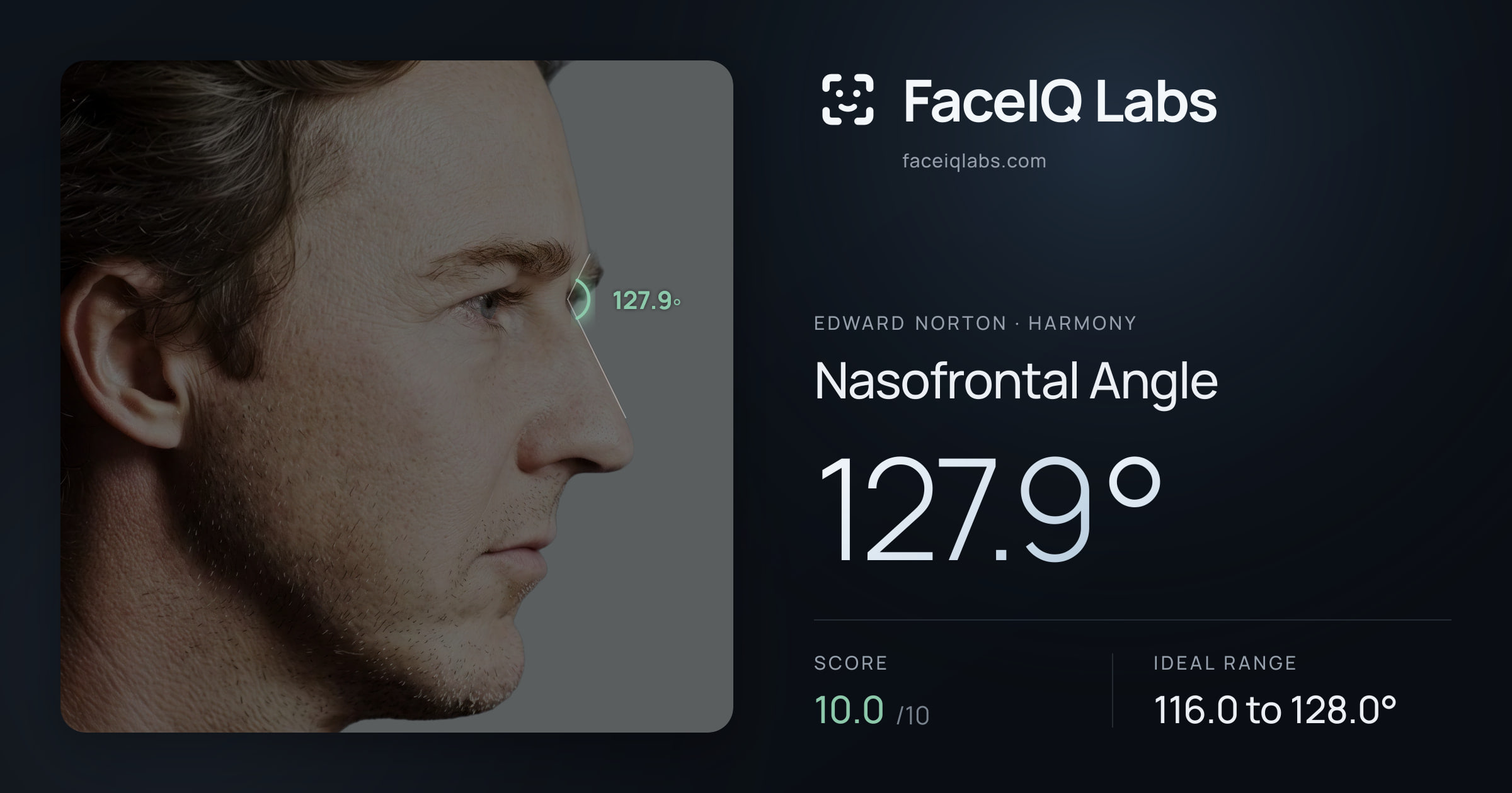 Edward Norton Nasofrontal Angle: 127.9°, drawn on the photo