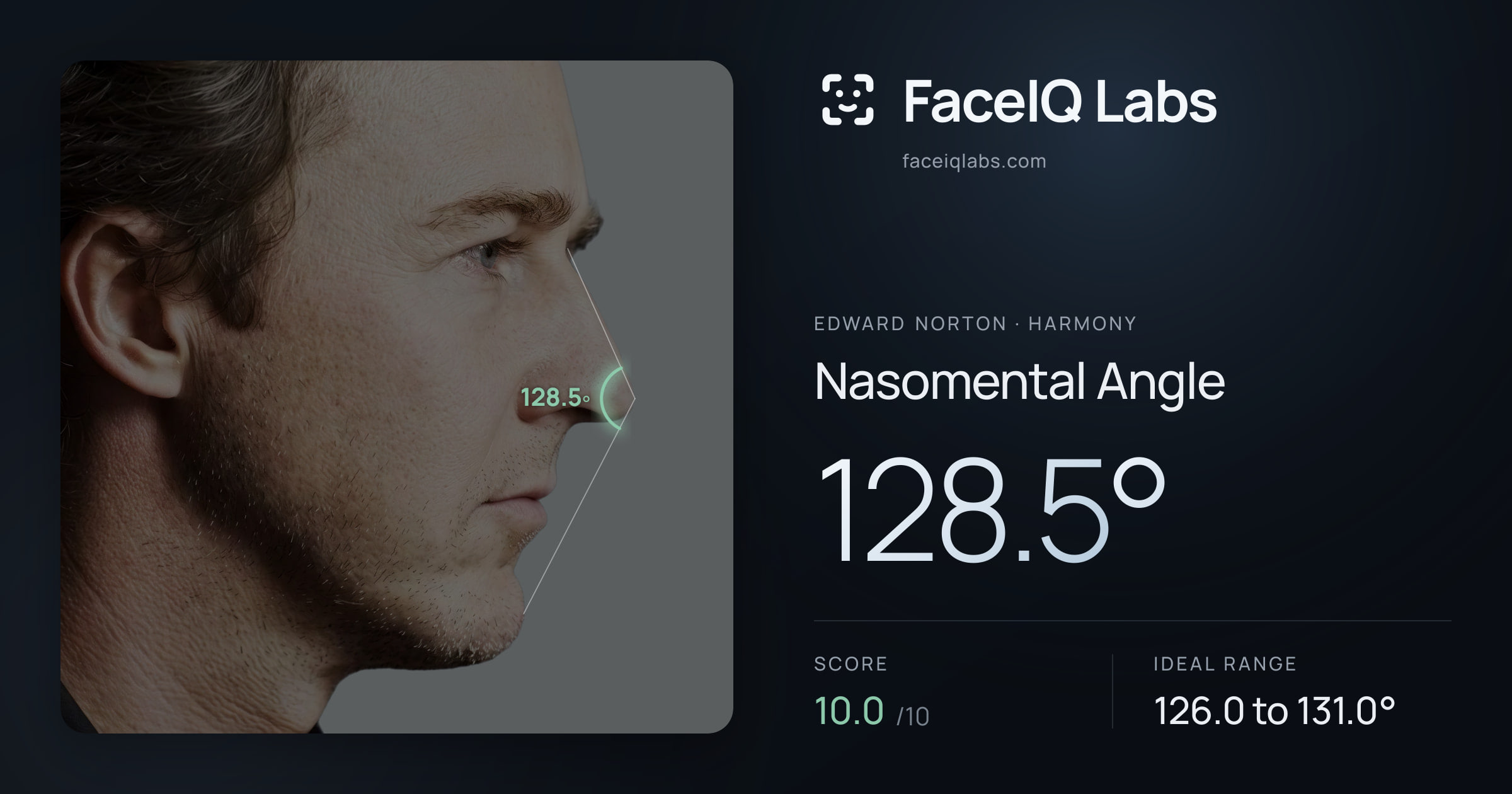 Edward Norton Nasomental Angle: 128.5°, drawn on the photo