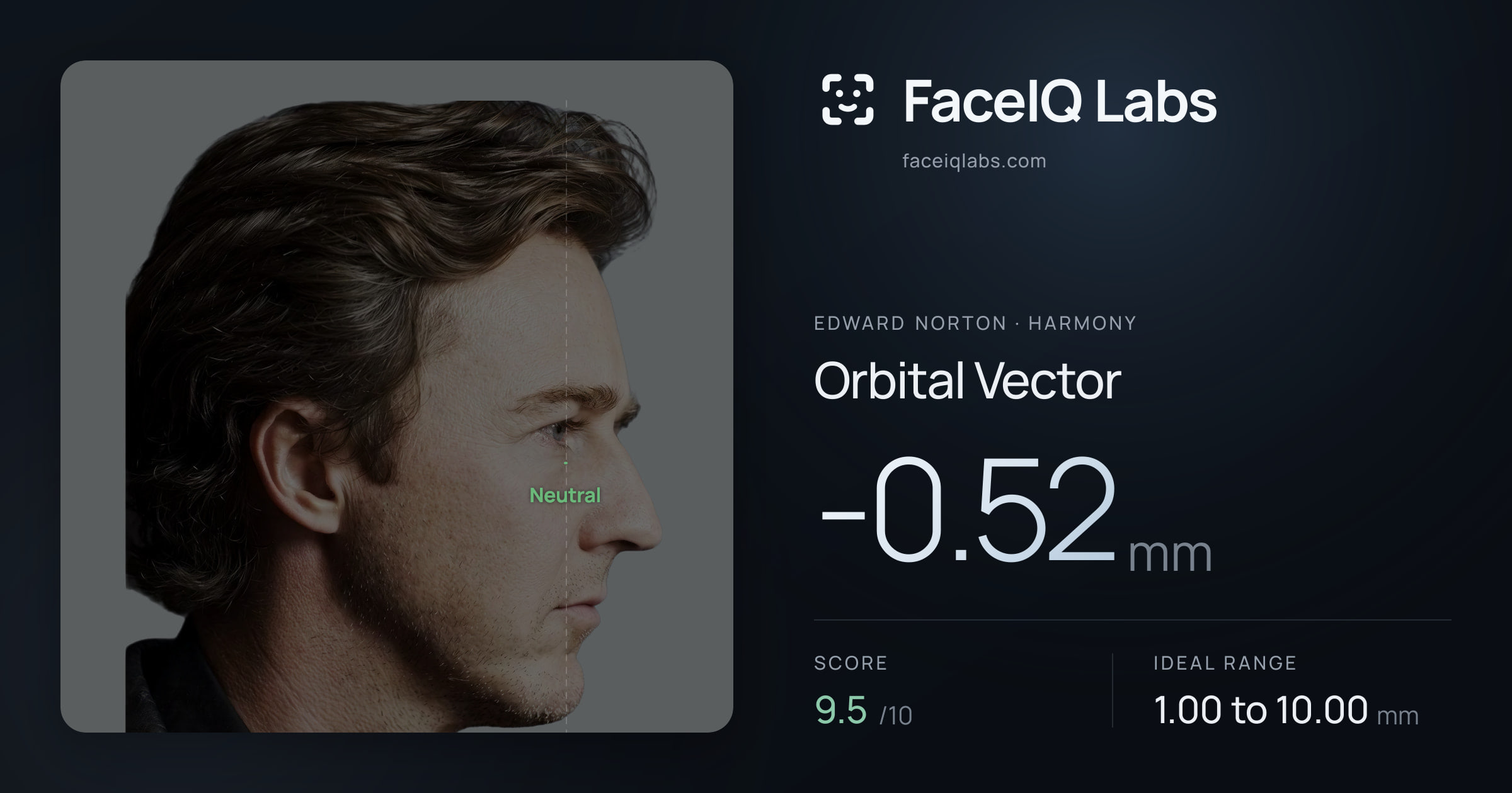 Edward Norton Orbital Vector: -0.52mm, drawn on the photo