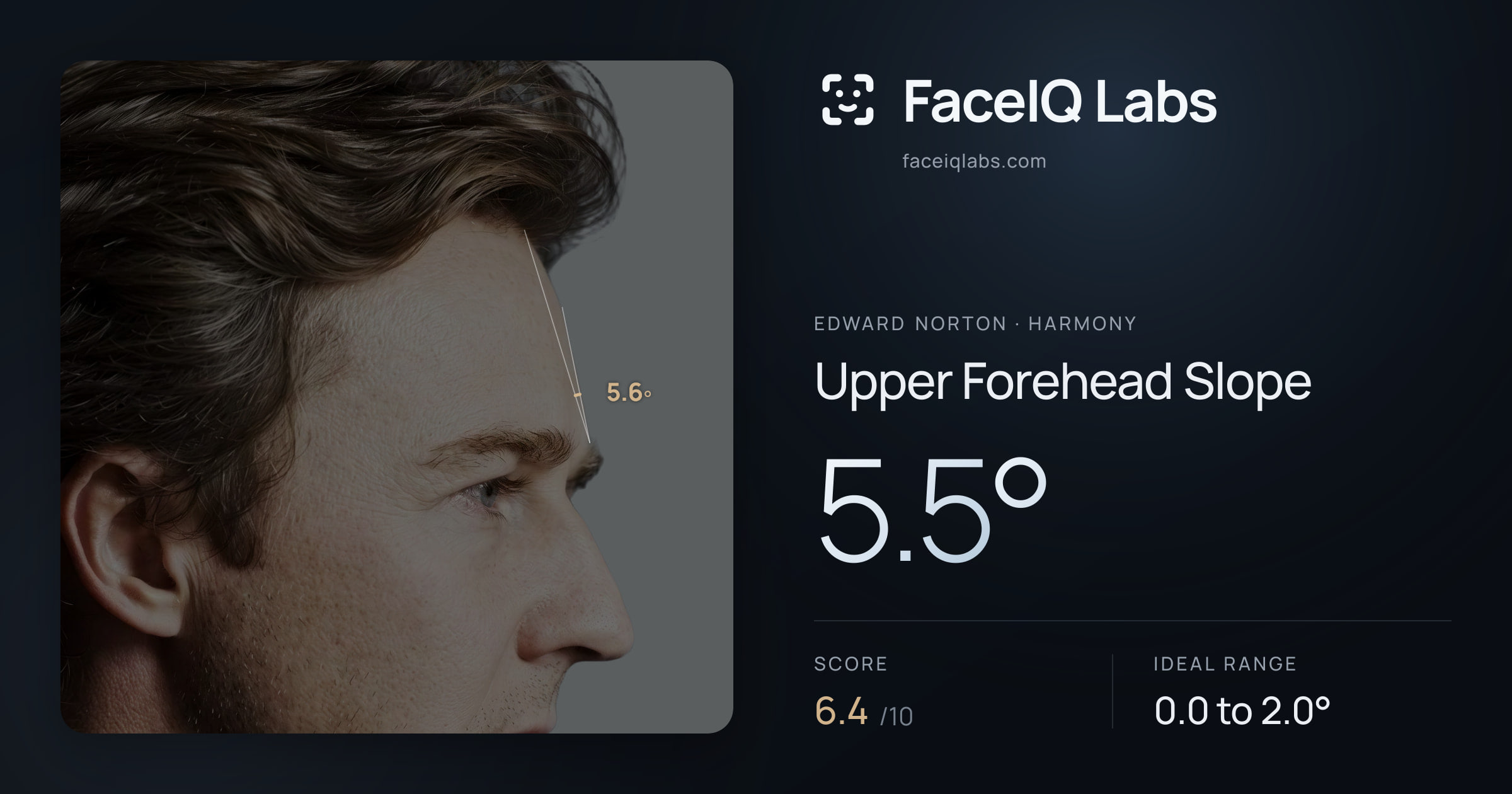Edward Norton Upper Forehead Slope: 5.5°, drawn on the photo
