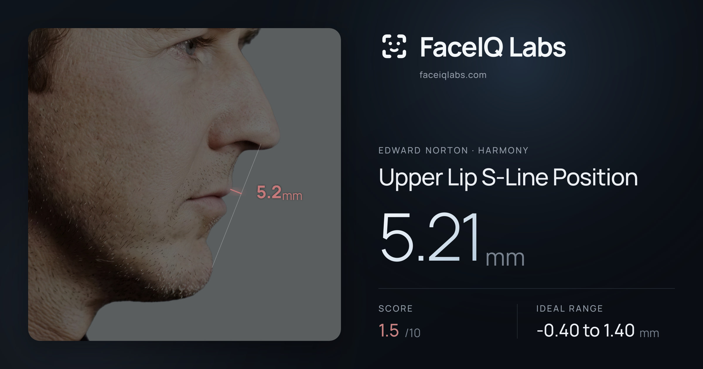 Edward Norton Upper Lip S-Line Position: 5.21mm, drawn on the photo