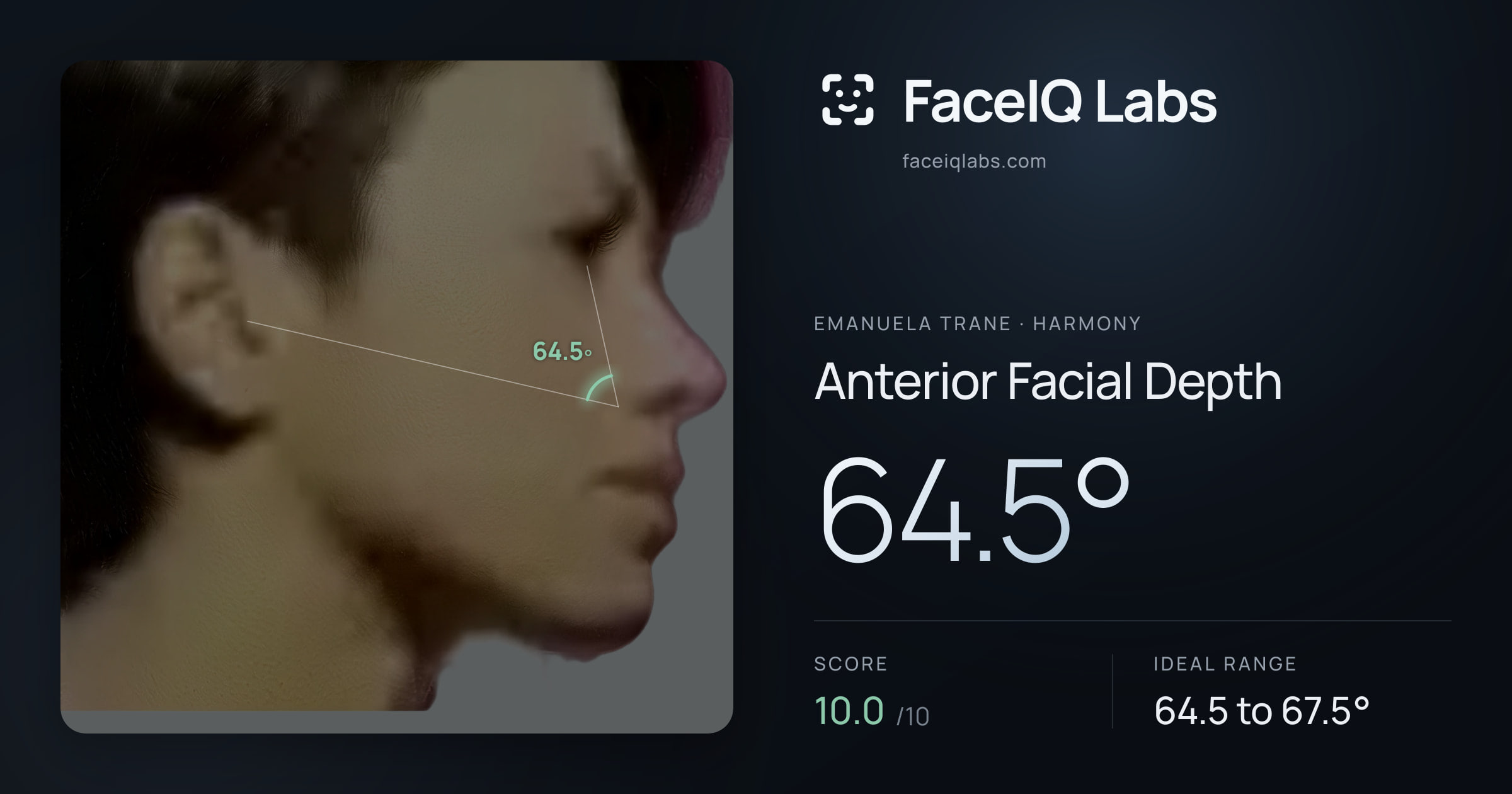 Emanuela Trane Anterior Facial Depth: 64.5°, drawn on the photo