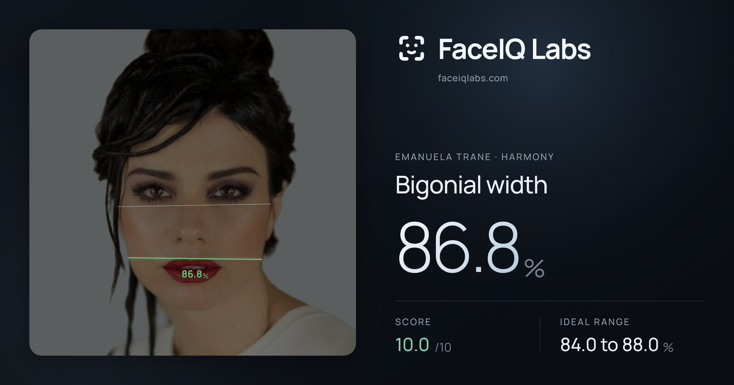 Emanuela Trane Bigonial width: 86.8%, drawn on the photo