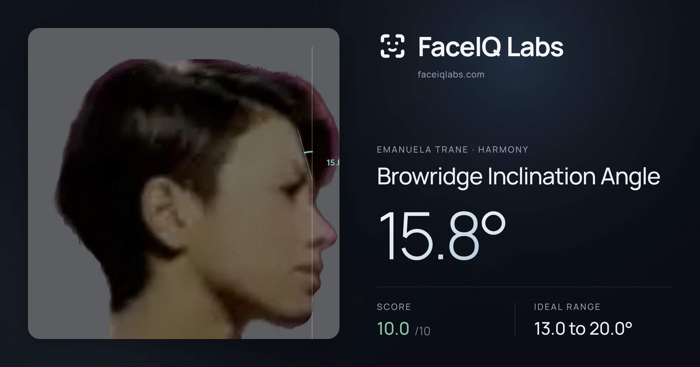 Emanuela Trane Browridge Inclination Angle: 15.8°, drawn on the photo