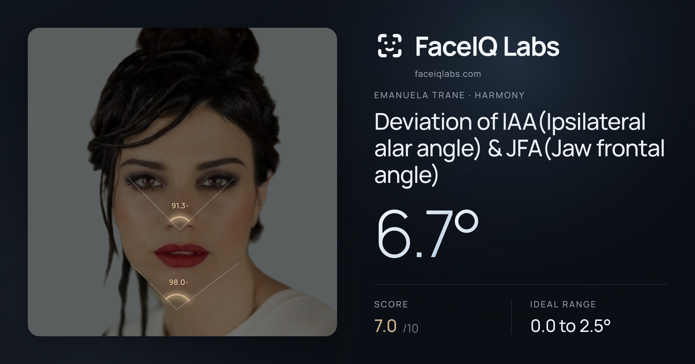 Emanuela Trane Deviation of IAA(Ipsilateral alar angle) & JFA(Jaw frontal angle): 6.7°, drawn on the photo