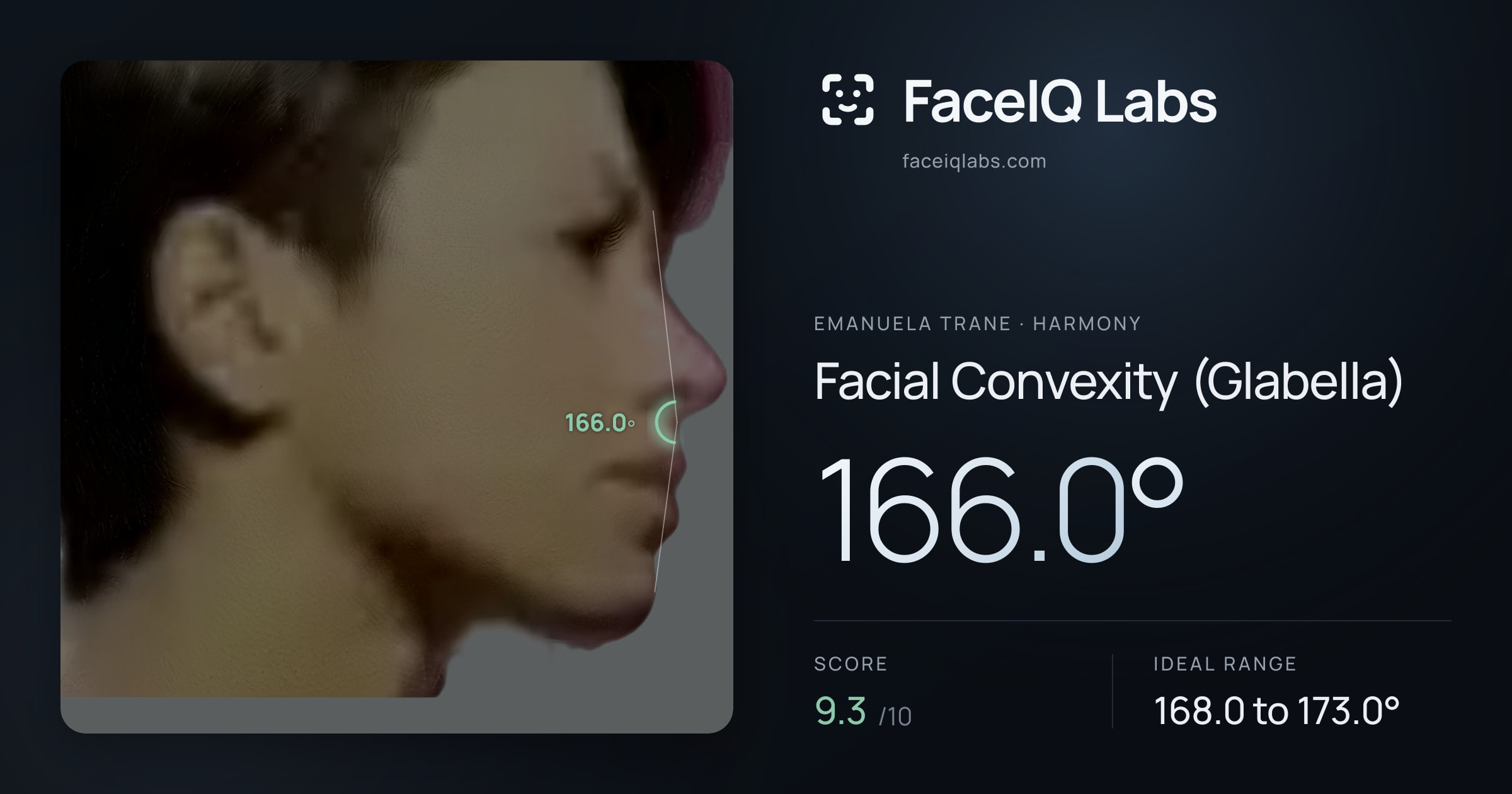 Emanuela Trane Facial Convexity (Glabella): 166.0°, drawn on the photo