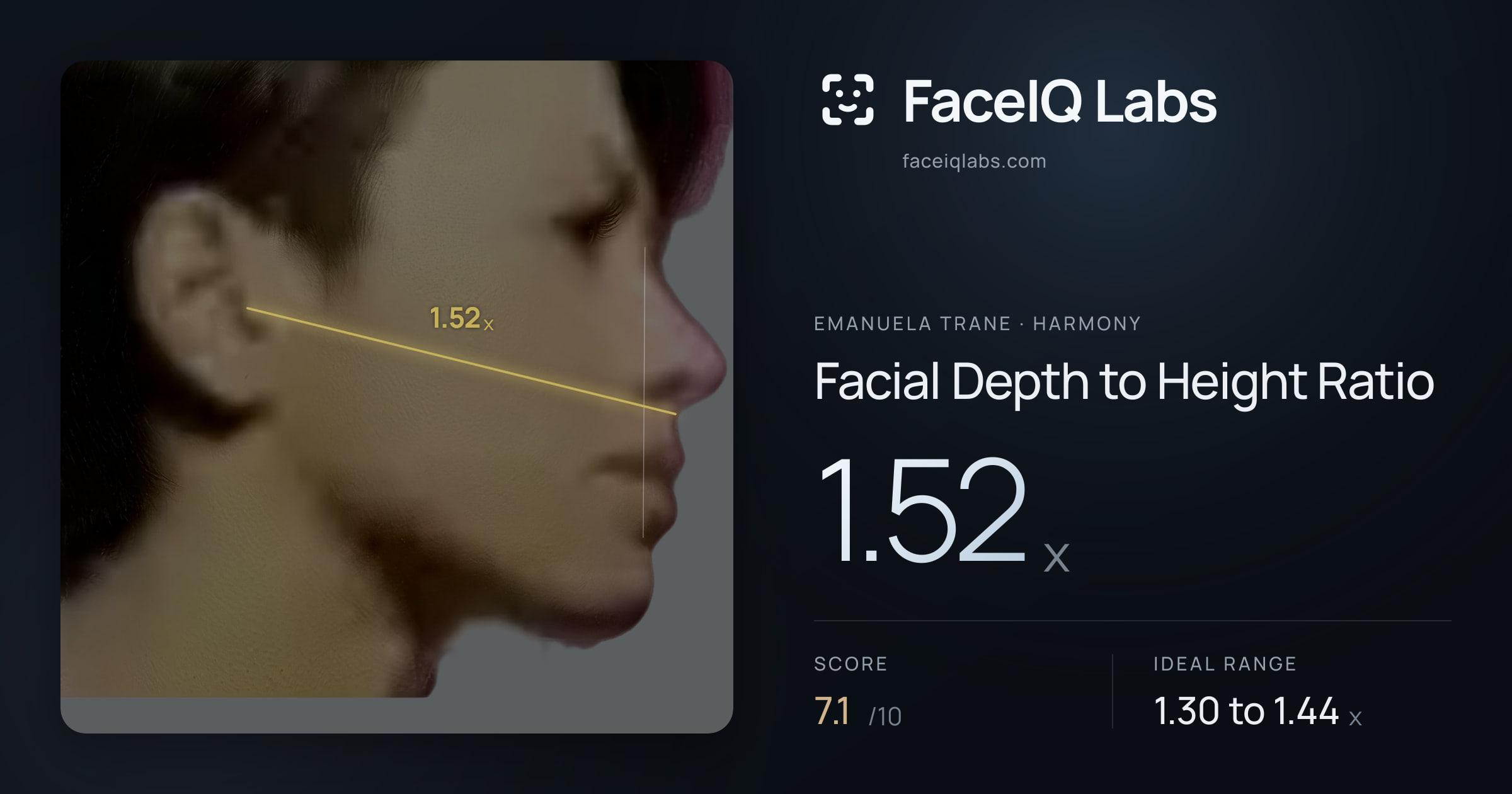 Emanuela Trane Facial Depth to Height Ratio: 1.52x, drawn on the photo